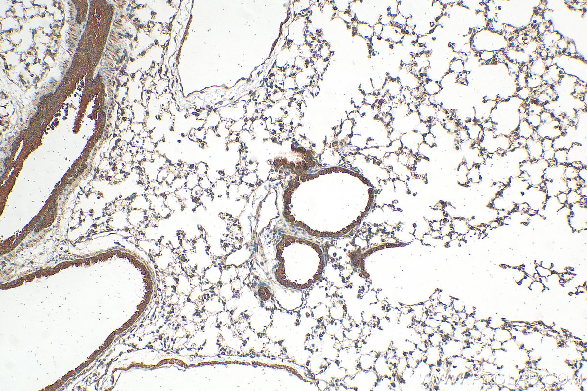 Immunohistochemistry (IHC) staining of mouse lung tissue using GSDMD Polyclonal antibody (20770-1-AP)