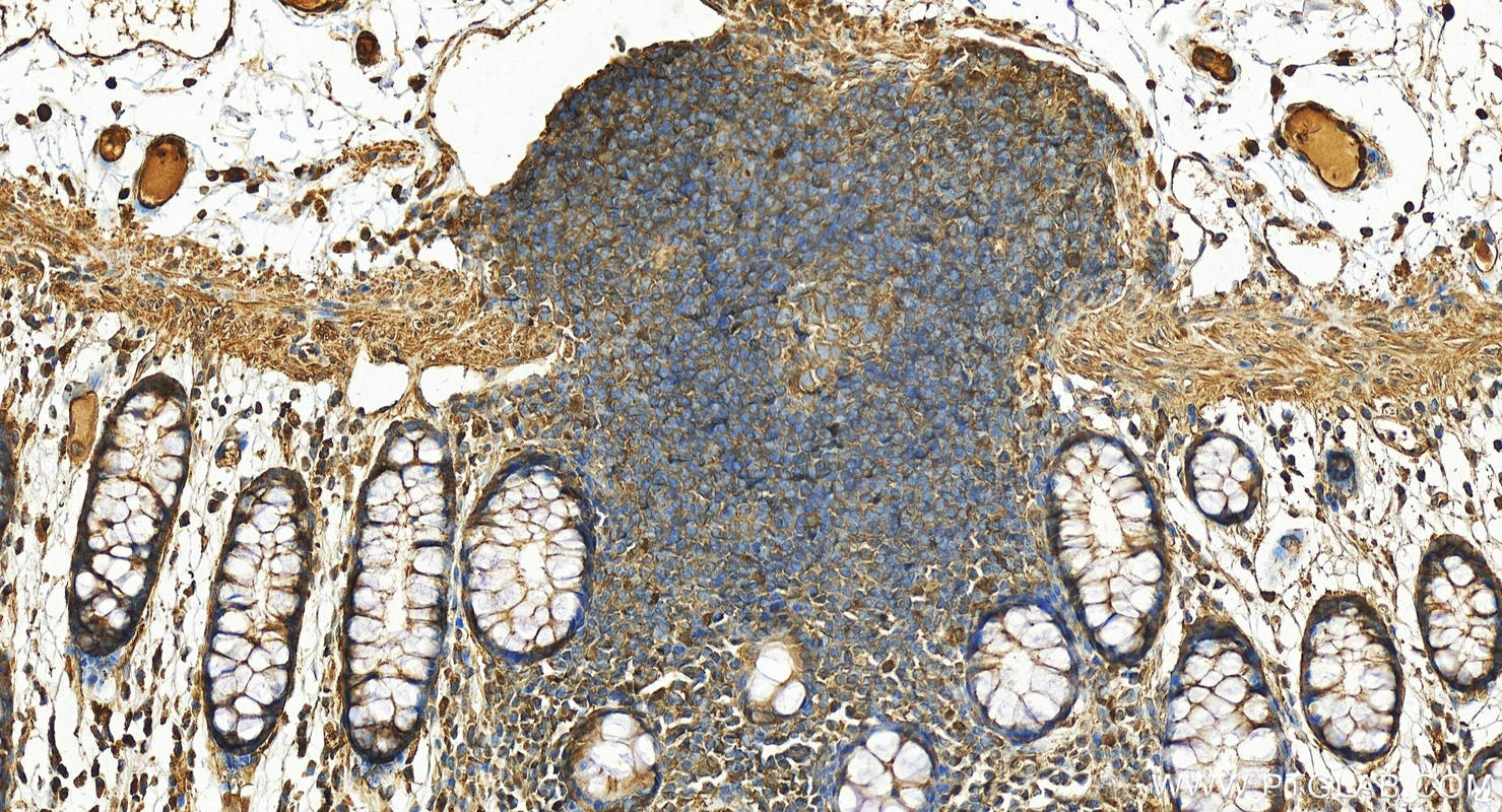 Immunohistochemistry (IHC) staining of human colon tissue using GSNOR,ADH5 Polyclonal antibody (11051-1-AP)