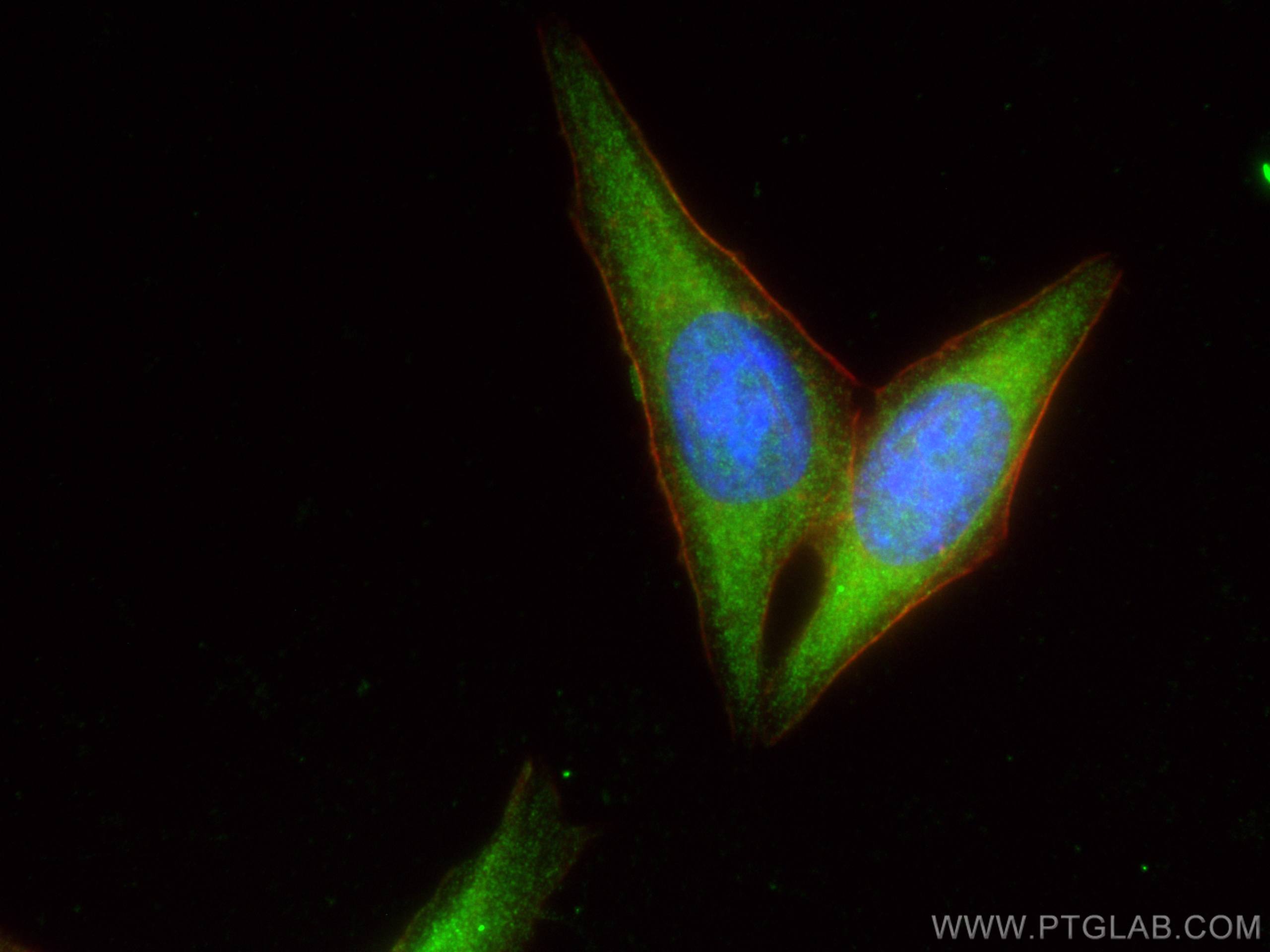 Immunofluorescence (IF) / fluorescent staining of HepG2 cells using GSNOR,ADH5 Polyclonal antibody (16379-1-AP)