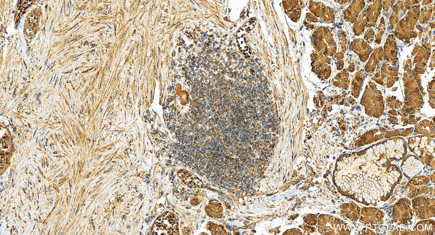 Immunohistochemistry (IHC) staining of human stomach tissue using eRF3a/GSPT1 Polyclonal antibody (28130-1-AP)