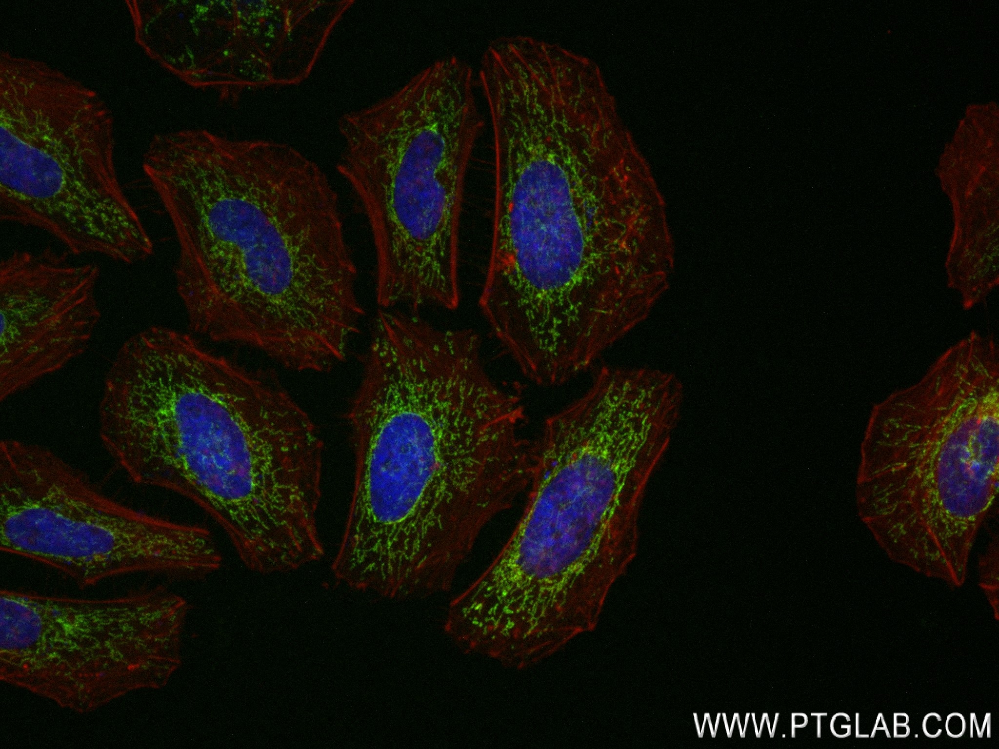 Immunofluorescence (IF) / fluorescent staining of HeLa cells using GSR Recombinant antibody (84480-2-RR)