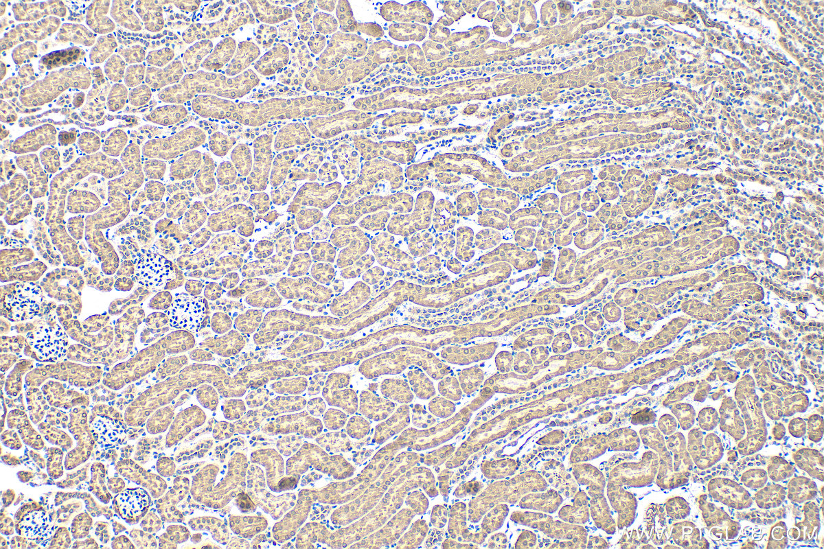 Immunohistochemistry (IHC) staining of mouse kidney tissue using GSS Polyclonal antibody (15712-1-AP)