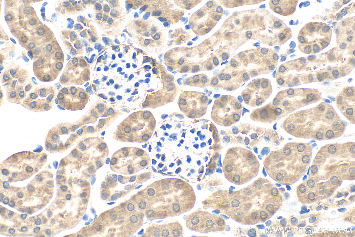 Immunohistochemistry (IHC) staining of mouse kidney tissue using GSS Polyclonal antibody (15712-1-AP)