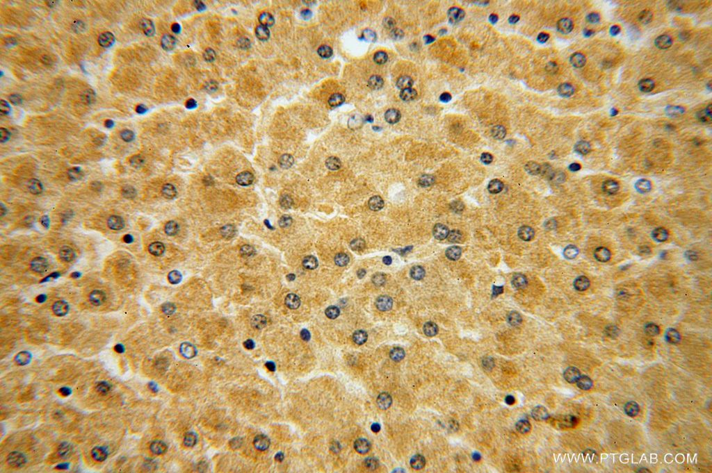 Immunohistochemistry (IHC) staining of human liver tissue using GSTCD Polyclonal antibody (17502-1-AP)