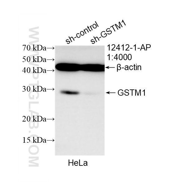 Western Blot (WB) analysis of HeLa cells using GSTM1 Polyclonal antibody (12412-1-AP)
