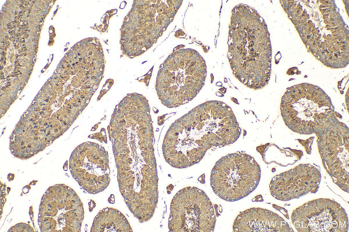 Immunohistochemistry (IHC) staining of mouse testis tissue using GSTM3 Polyclonal antibody (15214-1-AP)