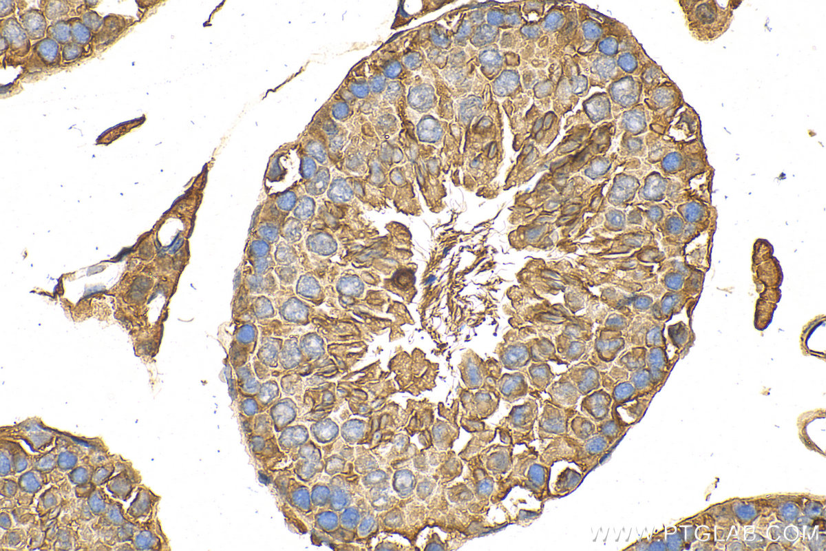 Immunohistochemistry (IHC) staining of mouse testis tissue using GSTM3 Polyclonal antibody (15214-1-AP)