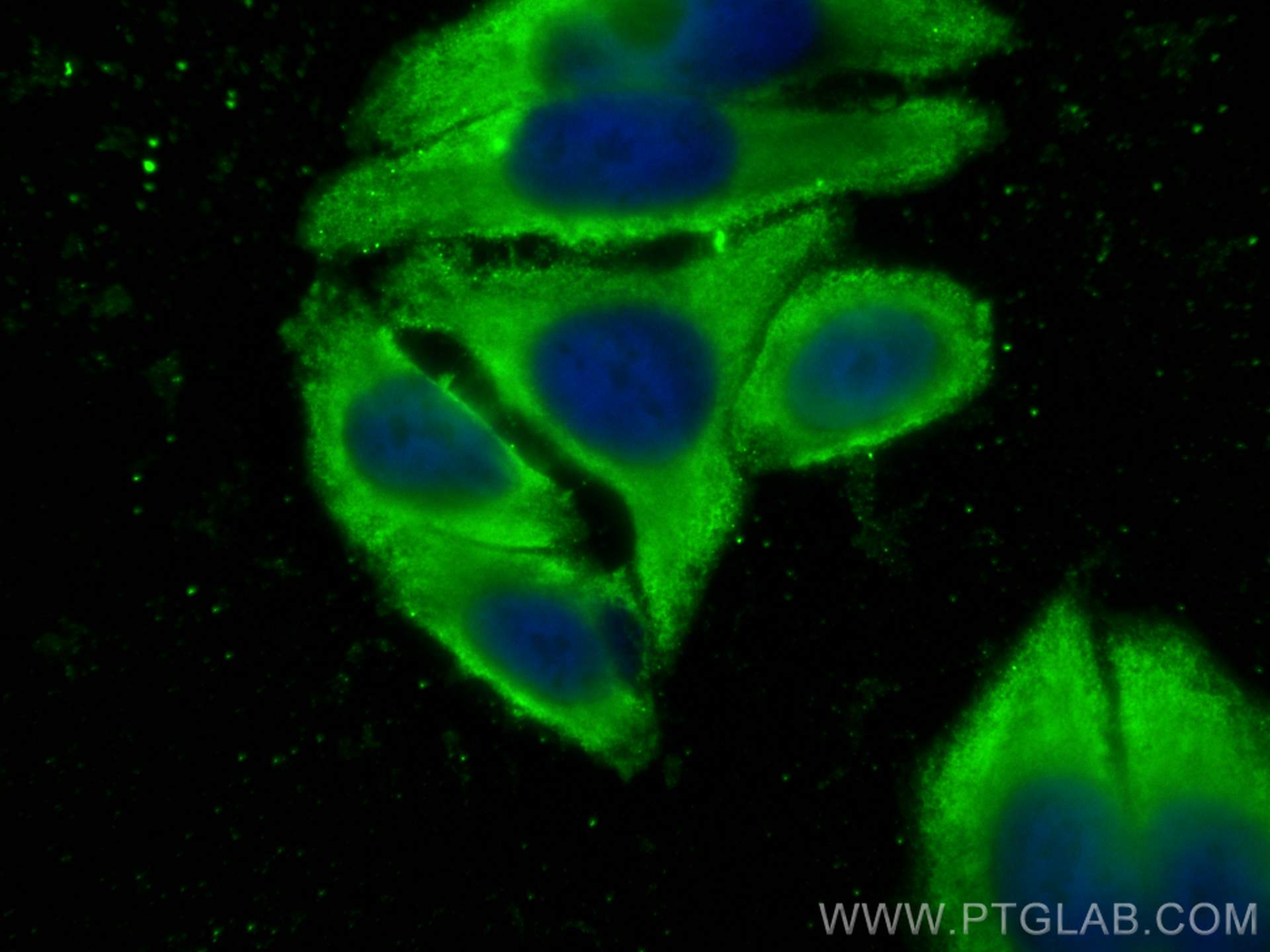 Immunofluorescence (IF) / fluorescent staining of HepG2 cells using GSTM5 Polyclonal antibody (14502-1-AP)