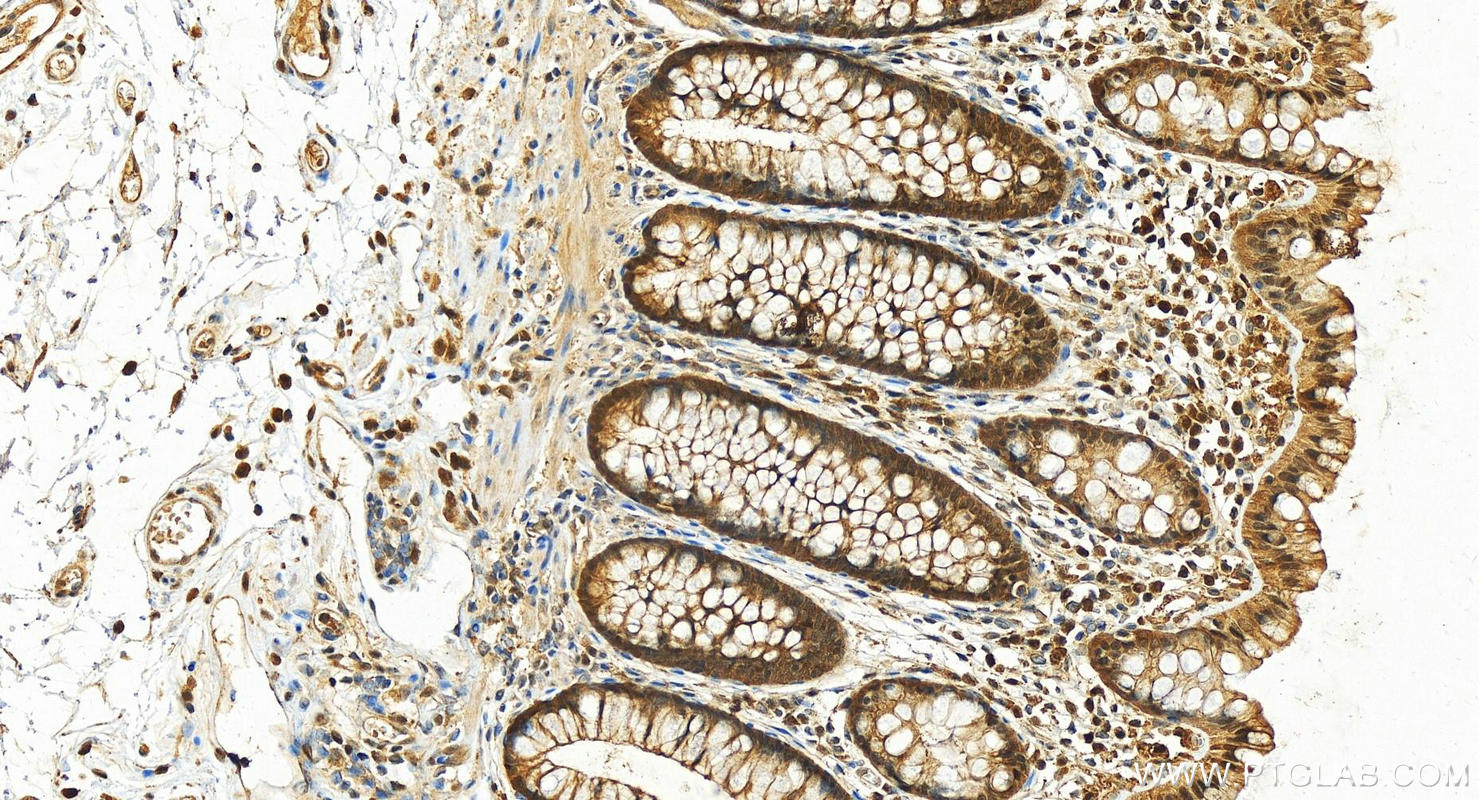 Immunohistochemistry (IHC) staining of human  colon using GSTP1 Polyclonal antibody (15902-1-AP)