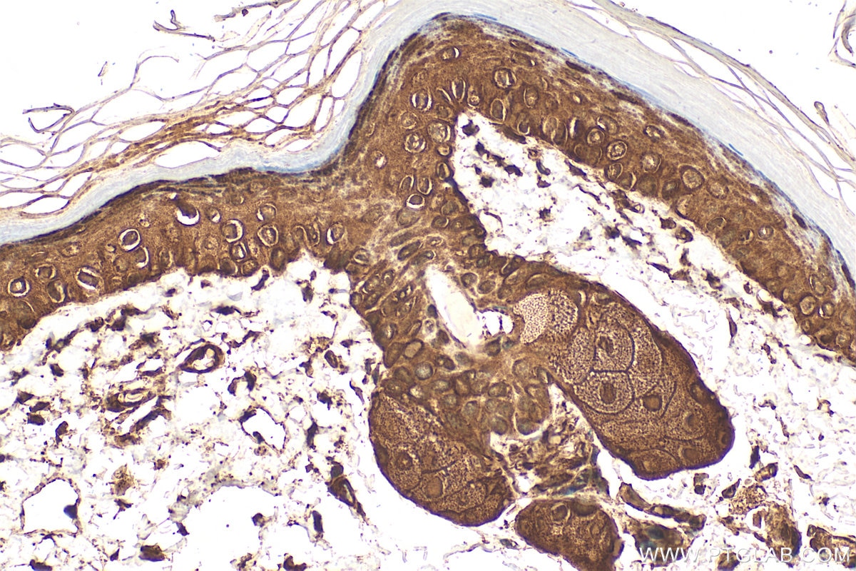 Immunohistochemistry (IHC) staining of mouse skin tissue using GSTP1 Polyclonal antibody (15902-1-AP)
