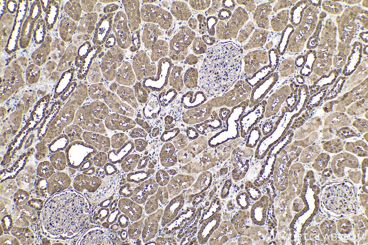 Immunohistochemistry (IHC) staining of human kidney tissue using GSTP1 Monoclonal antibody (66715-1-Ig)