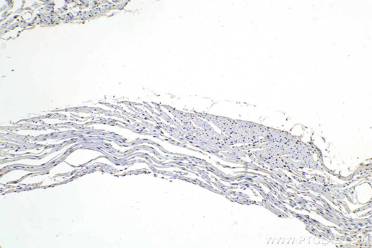 Immunohistochemistry (IHC) staining of mouse heart tissue using GTF2A2 Polyclonal antibody (10540-1-AP)