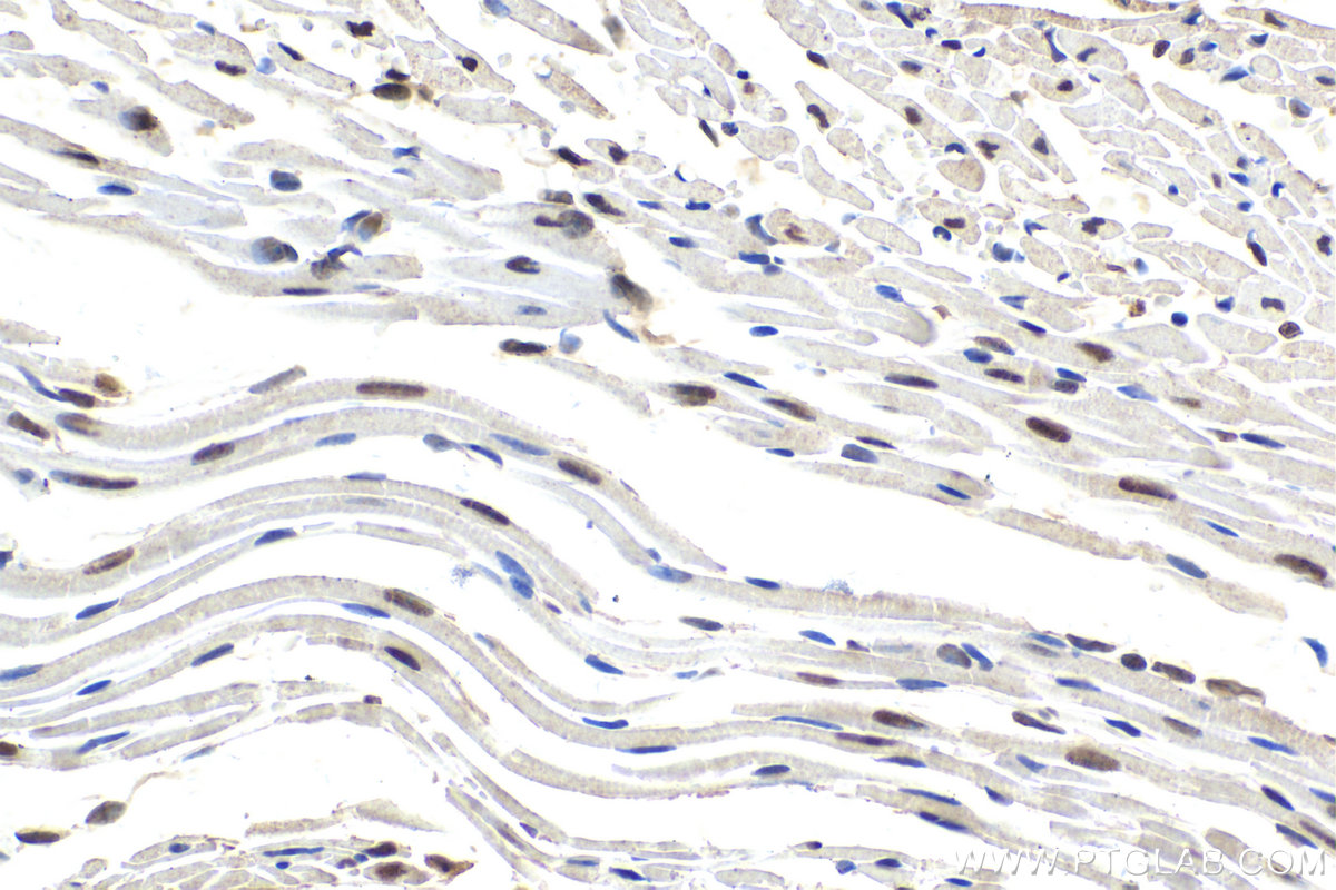 Immunohistochemistry (IHC) staining of mouse heart tissue using GTF2A2 Polyclonal antibody (10540-1-AP)