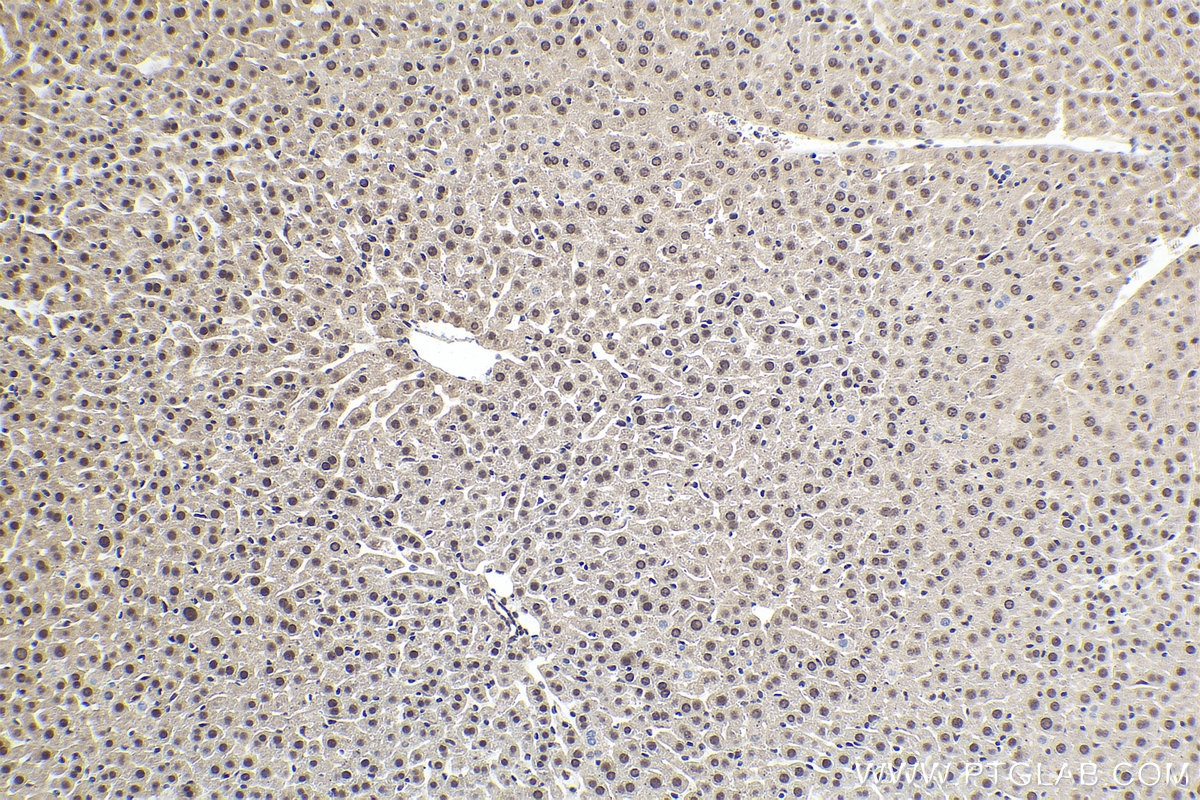 Immunohistochemistry (IHC) staining of mouse liver tissue using GTF2A2 Polyclonal antibody (10540-1-AP)