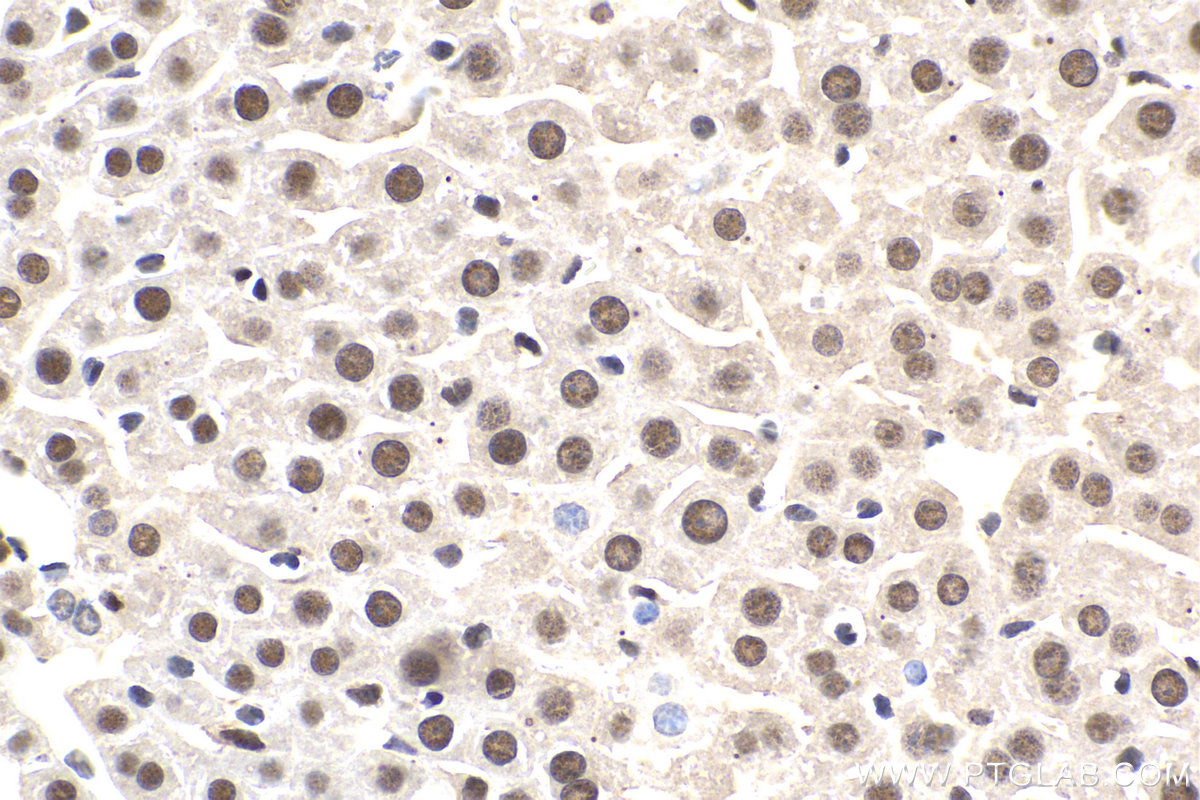 Immunohistochemistry (IHC) staining of mouse liver tissue using GTF2A2 Polyclonal antibody (10540-1-AP)