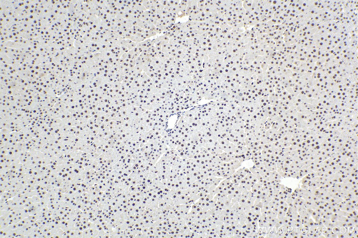 Immunohistochemistry (IHC) staining of rat liver tissue using GTF2A2 Polyclonal antibody (10540-1-AP)