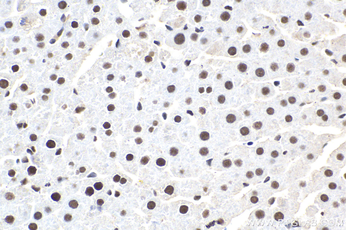 Immunohistochemistry (IHC) staining of rat liver tissue using GTF2A2 Polyclonal antibody (10540-1-AP)