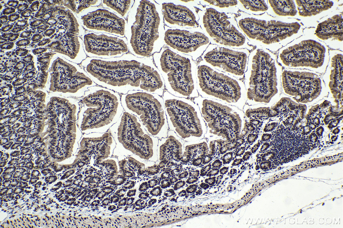 Immunohistochemistry (IHC) staining of mouse small intestine tissue using TFII I Polyclonal antibody (10499-1-AP)