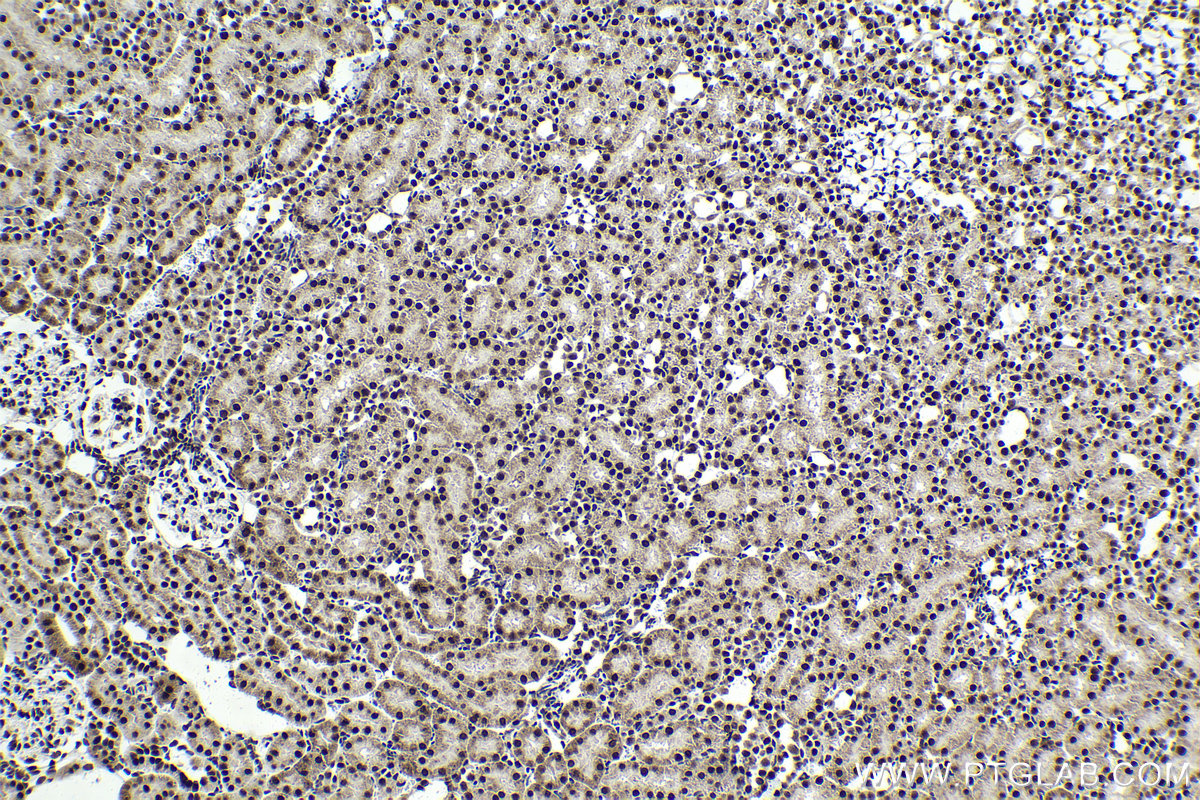 Immunohistochemistry (IHC) staining of rat kidney tissue using TFII I Polyclonal antibody (10499-1-AP)