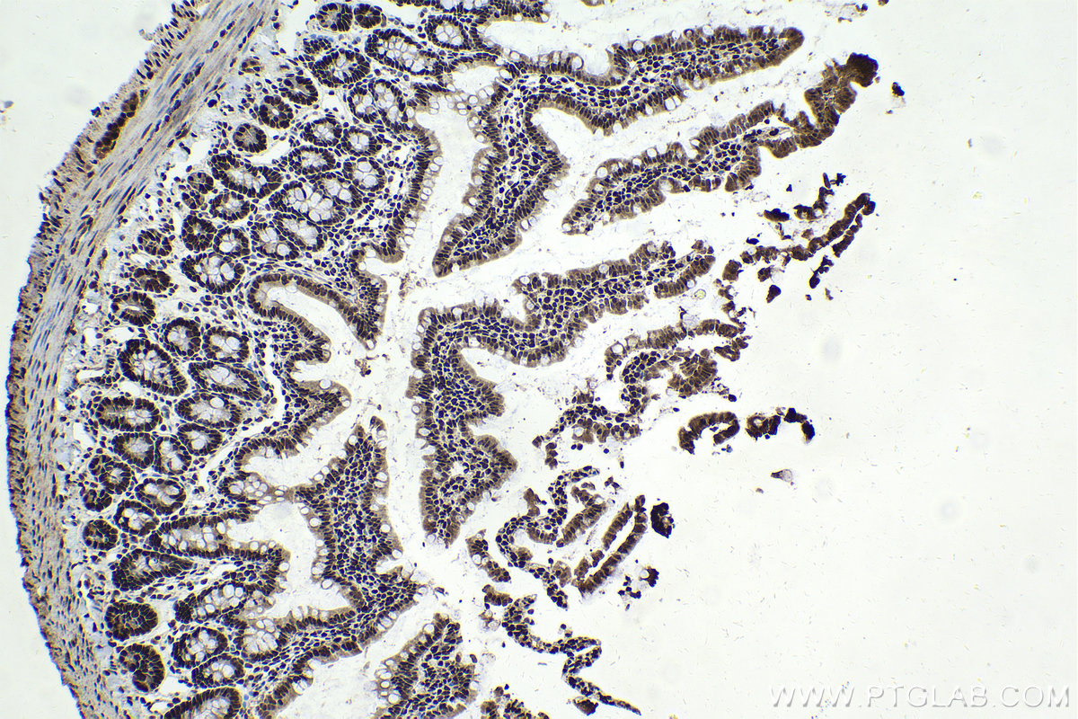 Immunohistochemistry (IHC) staining of rat small intestine tissue using TFII I Polyclonal antibody (10499-1-AP)