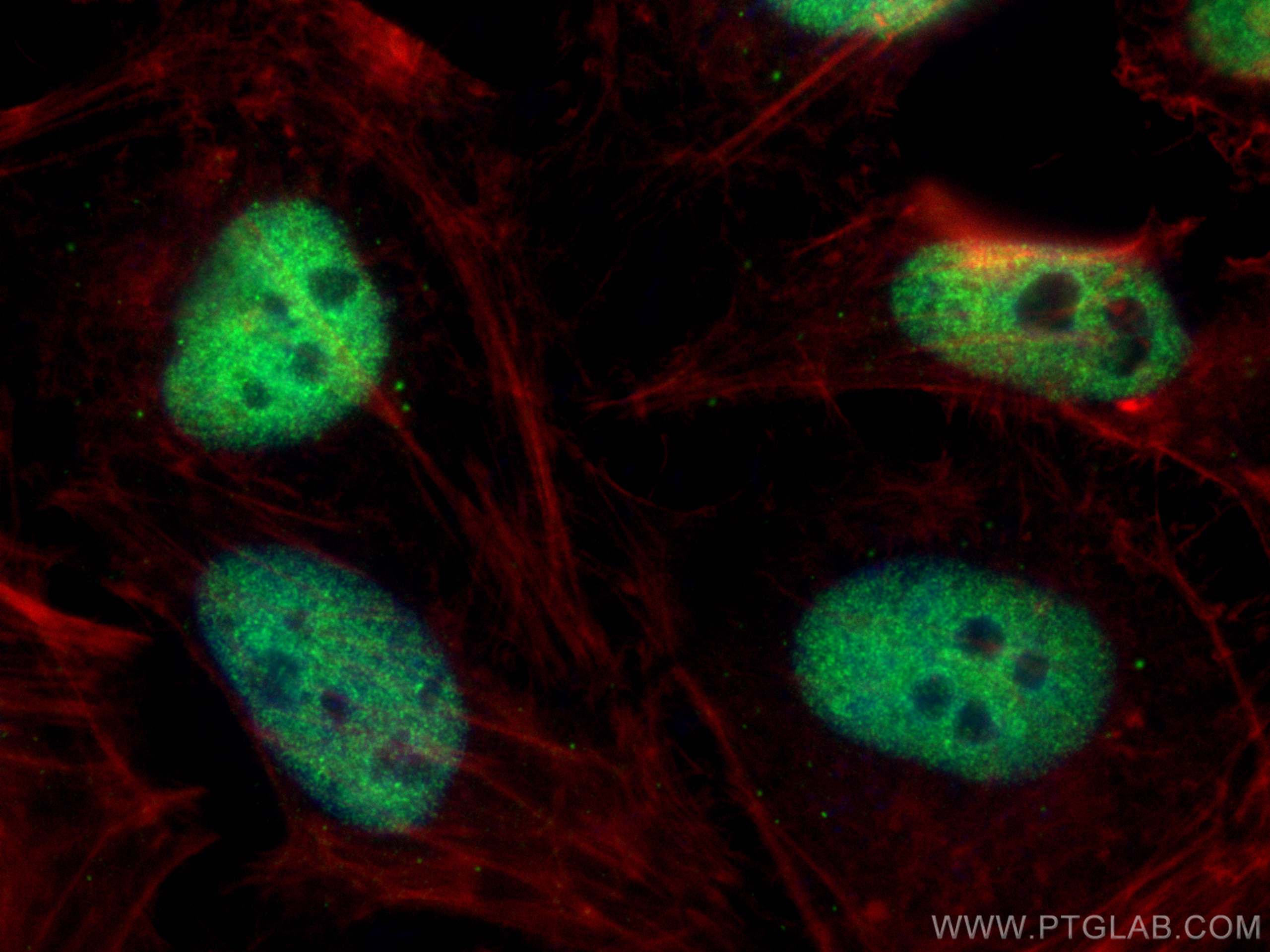 Immunofluorescence (IF) / fluorescent staining of HeLa cells using GTF3C2 Polyclonal antibody (27494-1-AP)