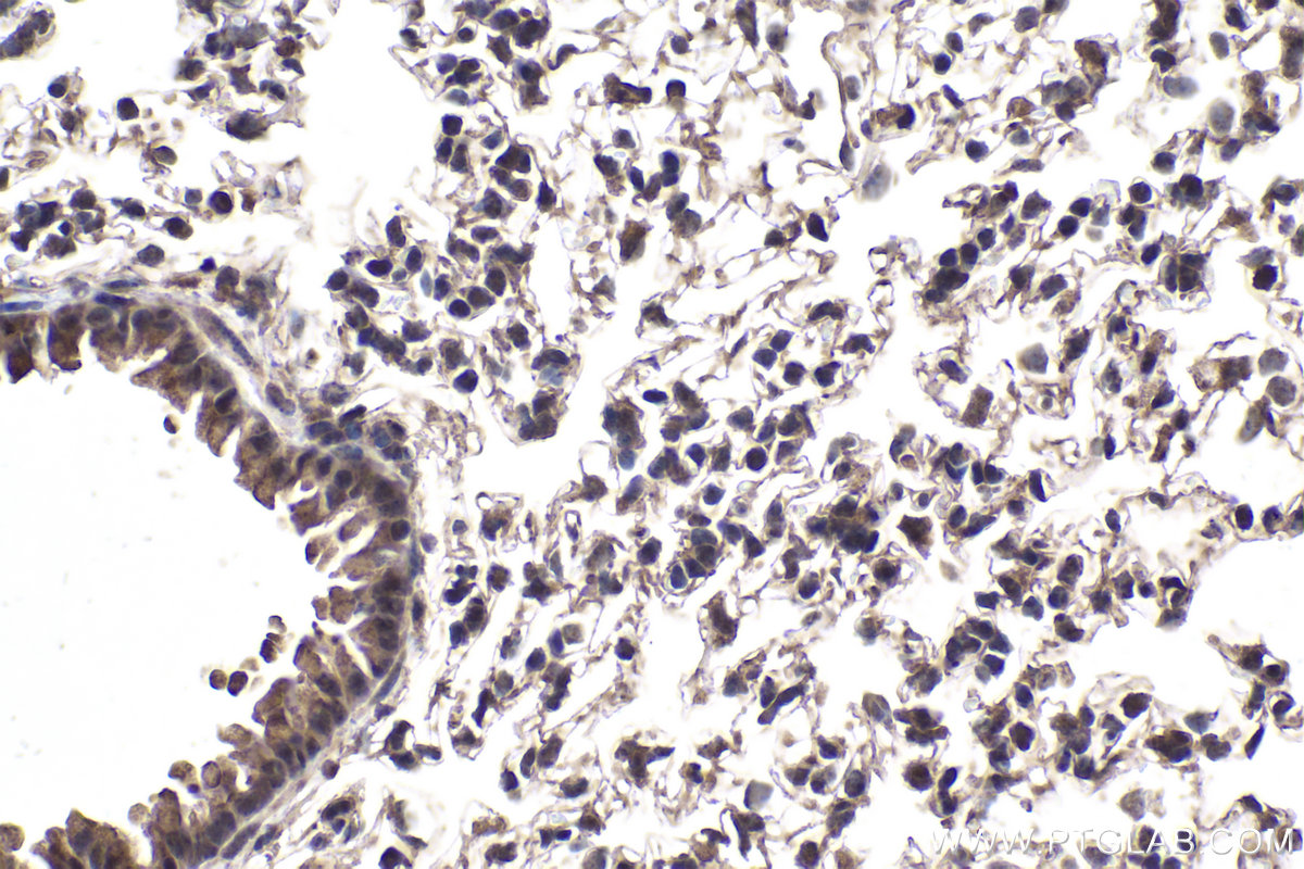 Immunohistochemistry (IHC) staining of mouse lung tissue using GTF3C6 Polyclonal antibody (26382-1-AP)