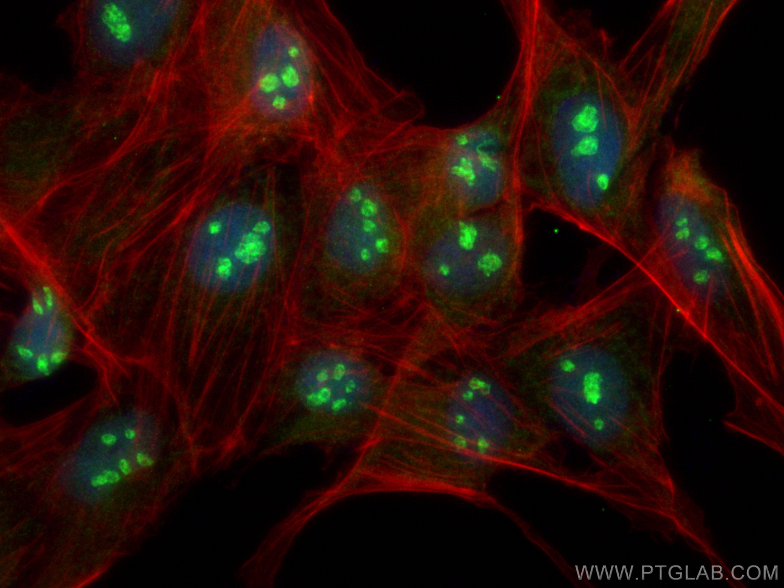 Immunofluorescence (IF) / fluorescent staining of MDCK cells using GTPBP4 Polyclonal antibody (13897-1-AP)