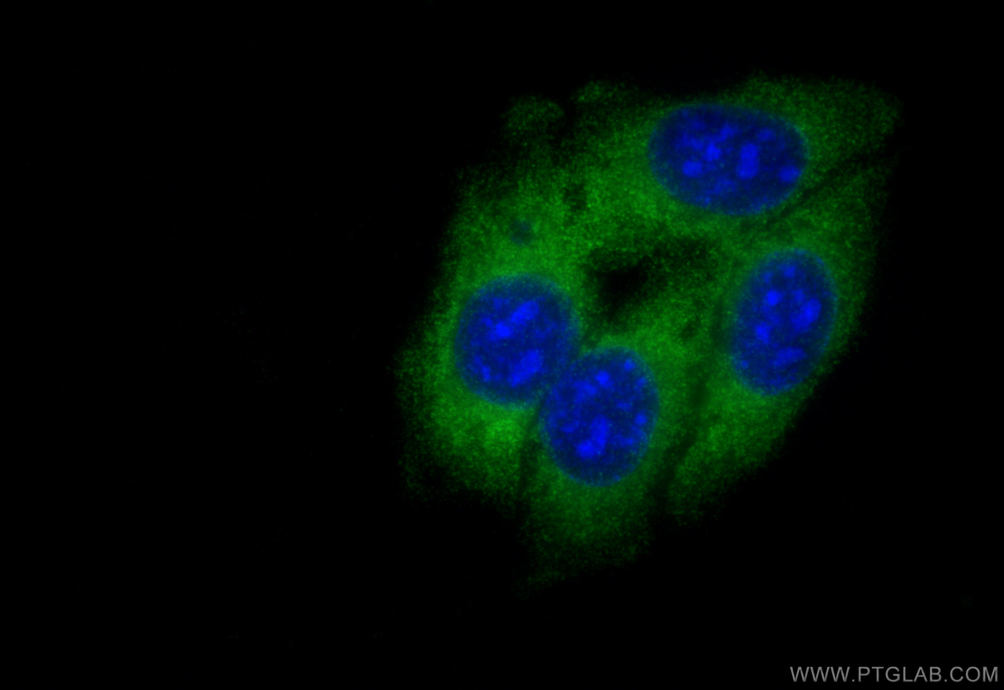 Immunofluorescence (IF) / fluorescent staining of HepG2 cells using GYS1 Polyclonal antibody (10566-1-AP)