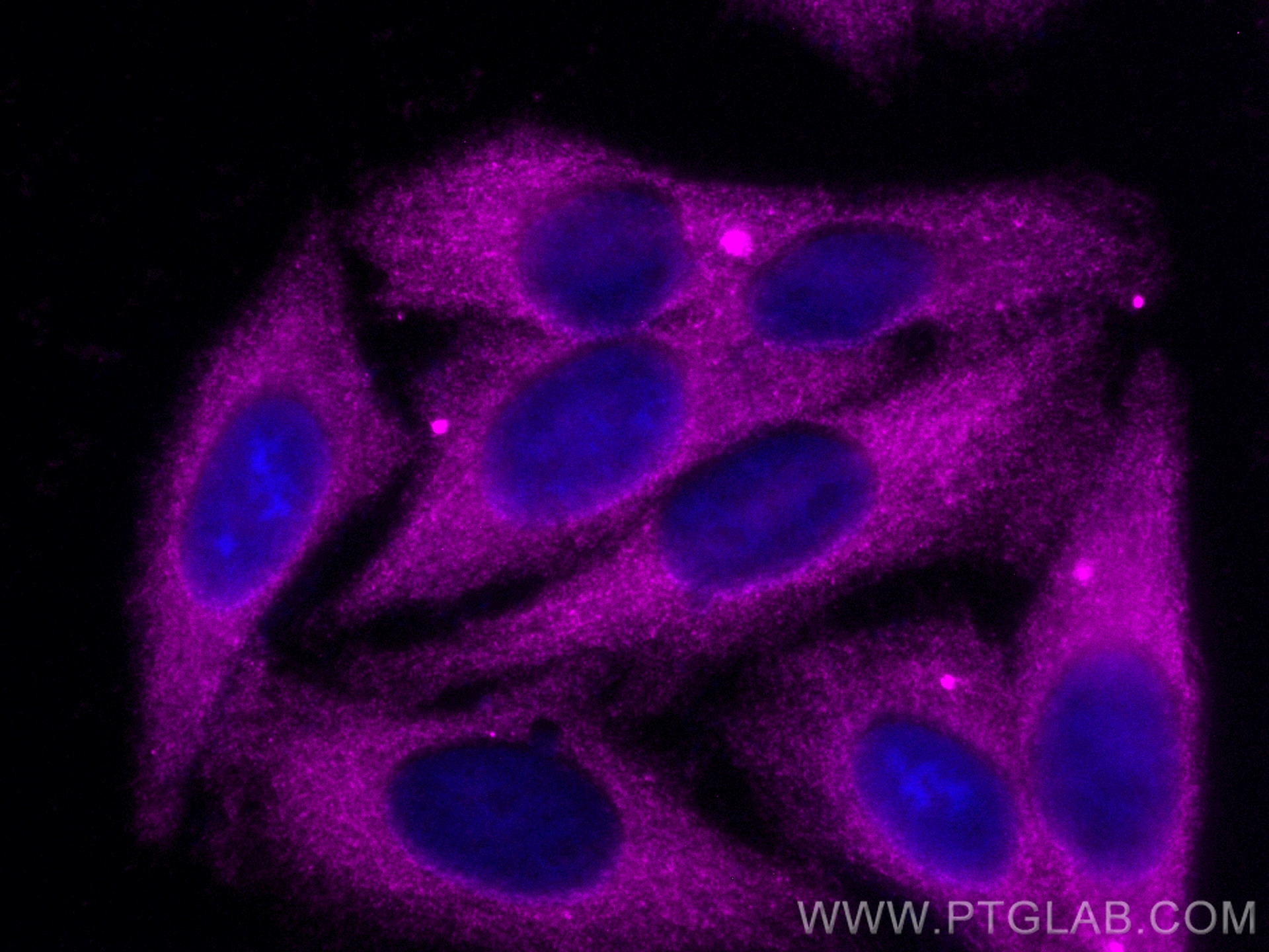 Immunofluorescence (IF) / fluorescent staining of HepG2 cells using CoraLite® Plus 647-conjugated GYS1 Polyclonal anti (CL647-10566)