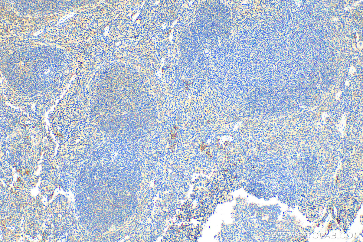 Immunohistochemistry (IHC) staining of mouse spleen tissue using Granzyme B Polyclonal antibody (13588-1-AP)