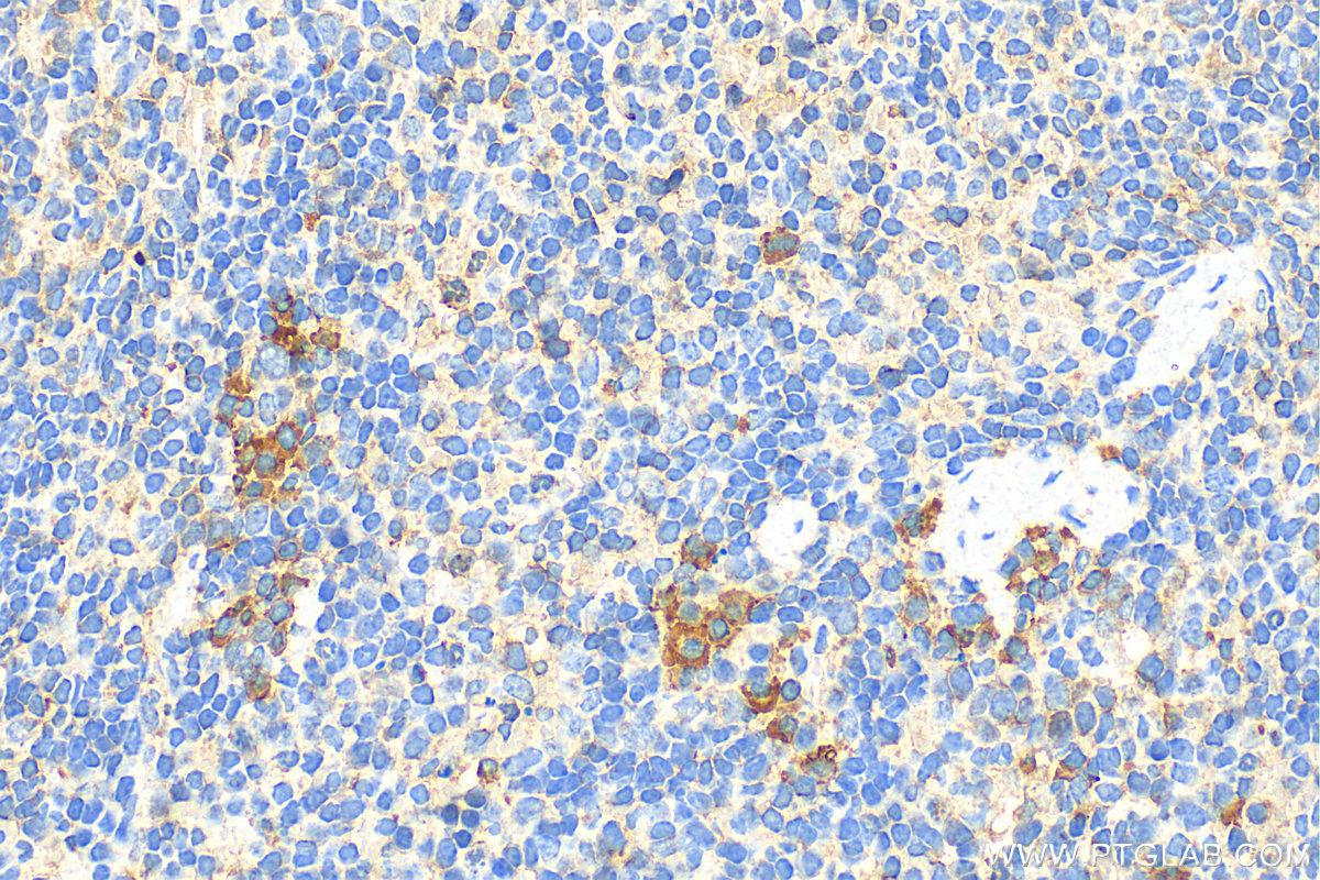 Immunohistochemistry (IHC) staining of mouse spleen tissue using Granzyme B Polyclonal antibody (13588-1-AP)