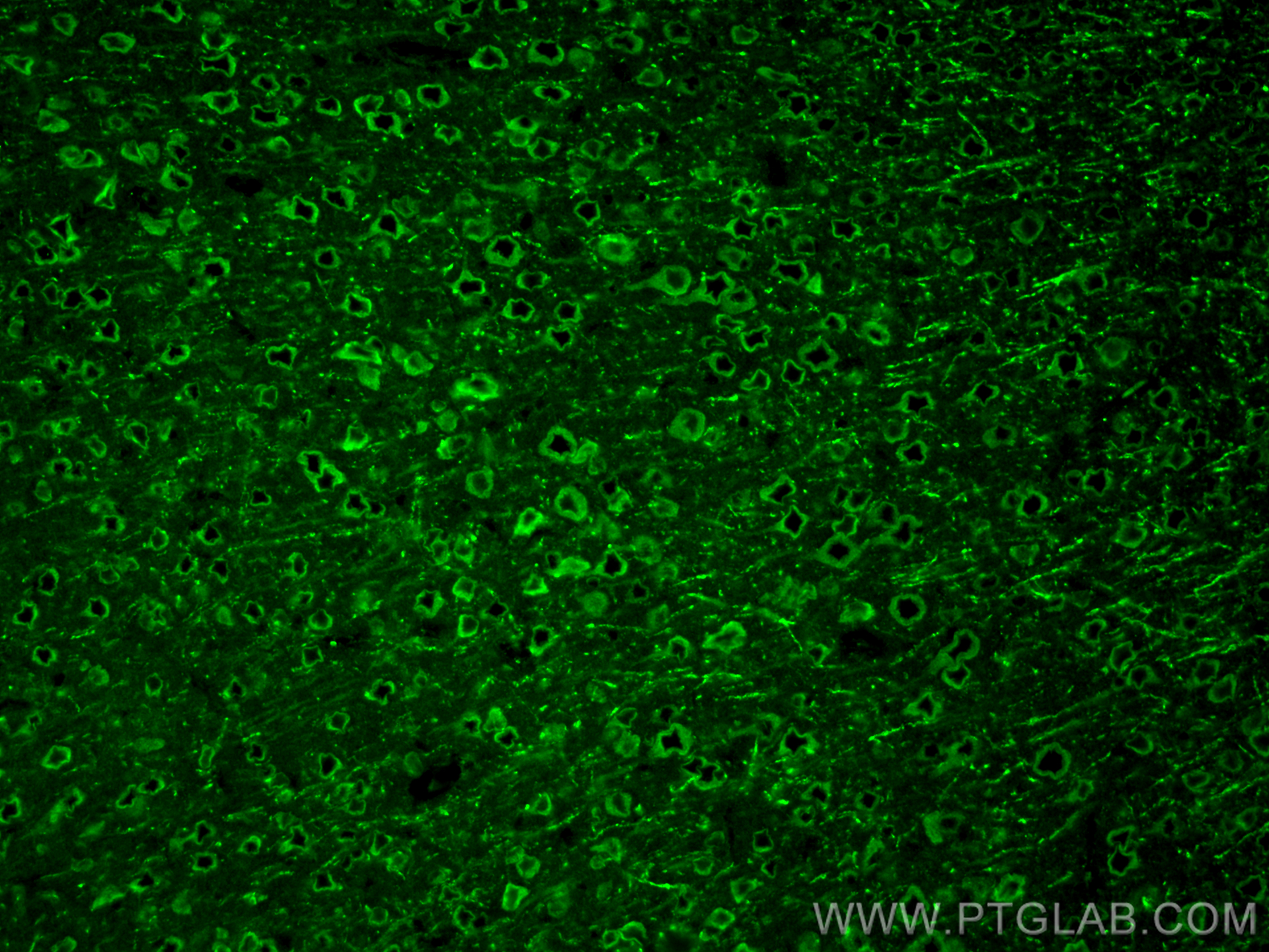 Immunofluorescence (IF) / fluorescent staining of mouse brain tissue using Galc Polyclonal antibody (11991-1-AP)