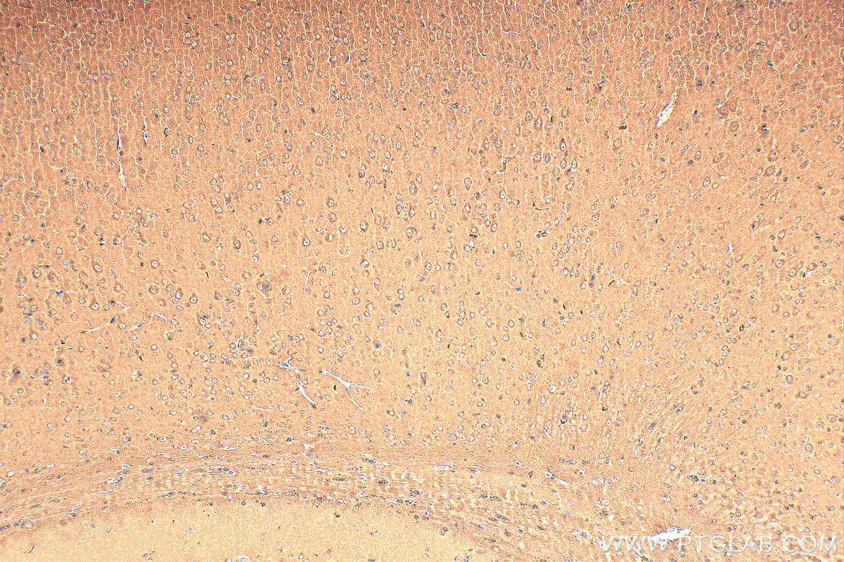 Immunohistochemistry (IHC) staining of mouse brain tissue using Galc Polyclonal antibody (11991-1-AP)