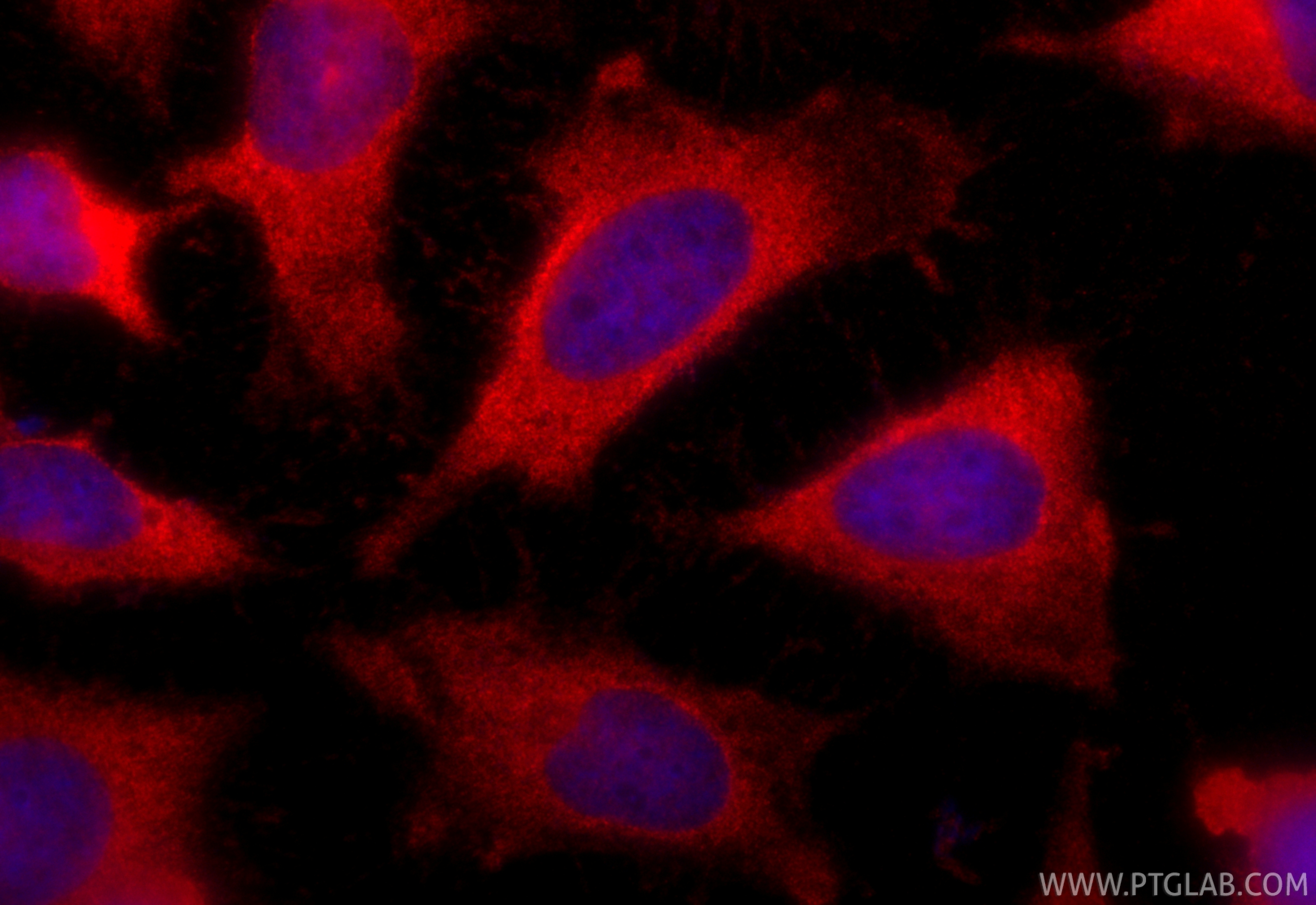 Immunofluorescence (IF) / fluorescent staining of HeLa cells using CoraLite®594-conjugated Galectin-1 Polyclonal anti (CL594-11858)