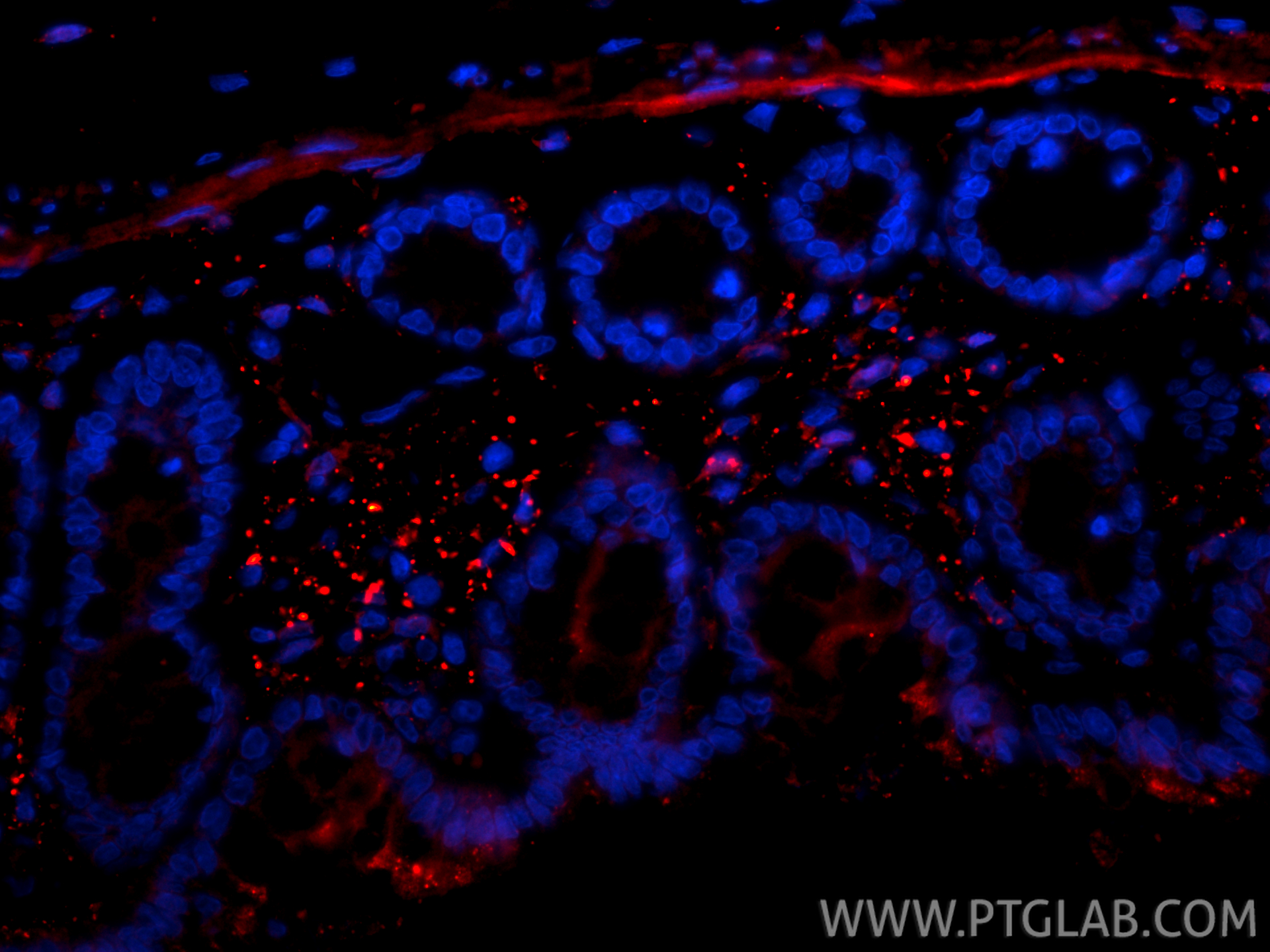 Immunofluorescence (IF) / fluorescent staining of rat colon tissue using CoraLite®594-conjugated Galectin-1 Polyclonal anti (CL594-11858)