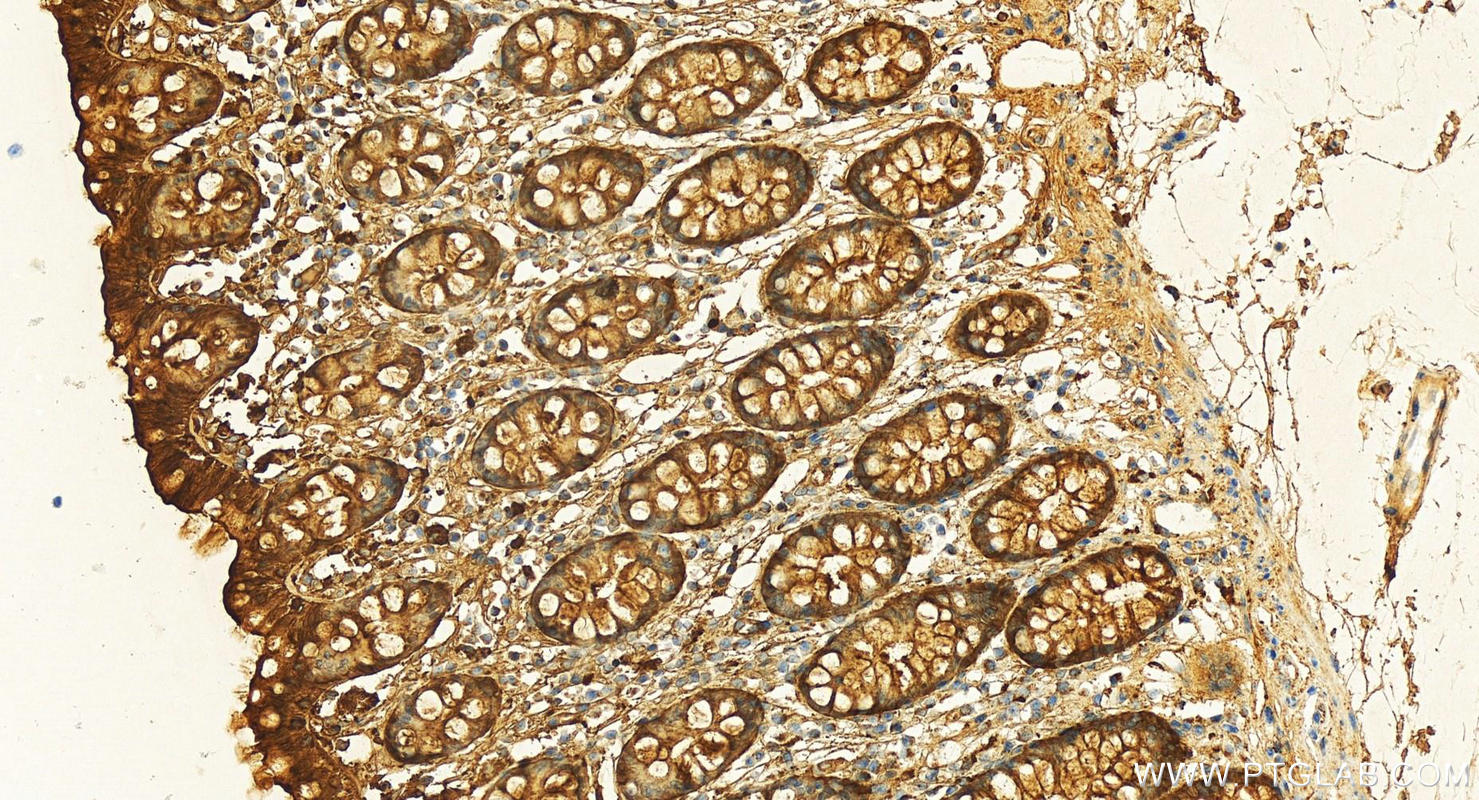 Immunohistochemistry (IHC) staining of human colon tissue using Galectin-3 Recombinant antibody (82024-1-RR)