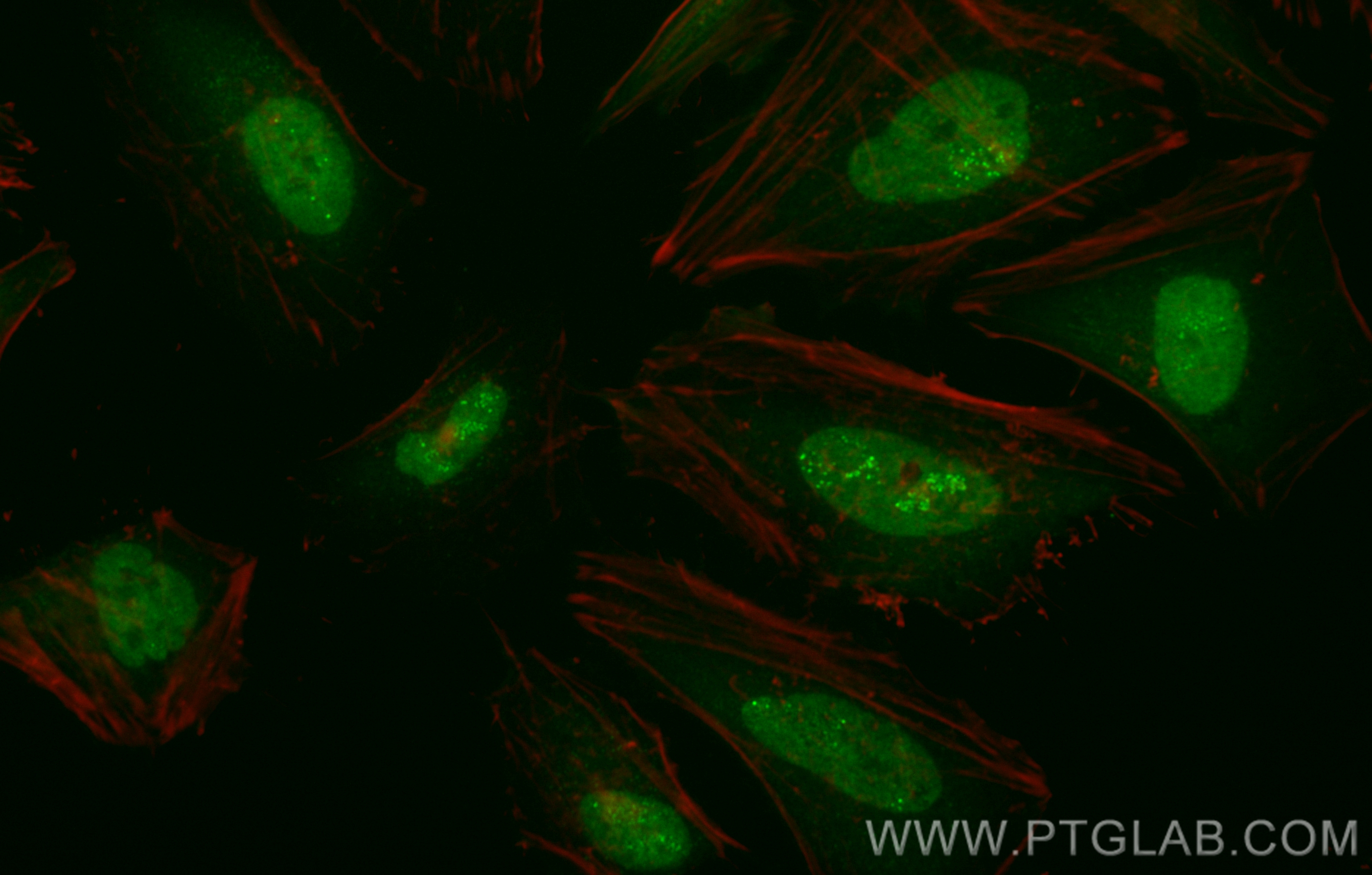 Galectin-3