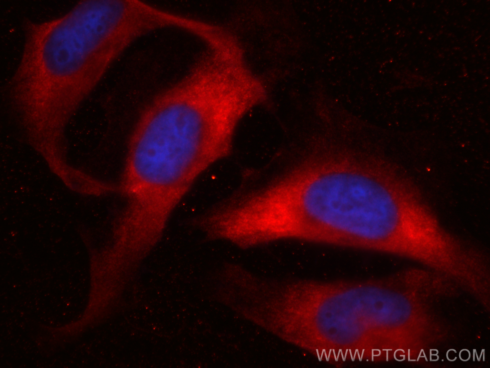 Immunofluorescence (IF) / fluorescent staining of HeLa cells using CoraLite®594-conjugated Galectin-3 Monoclonal anti (CL594-60207)