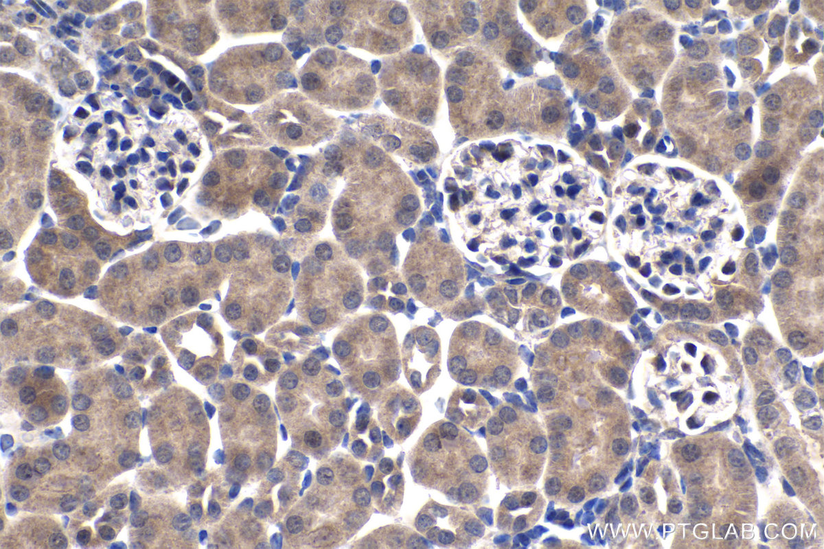 Immunohistochemistry (IHC) staining of mouse kidney tissue using Giantin Polyclonal antibody (22270-1-AP)