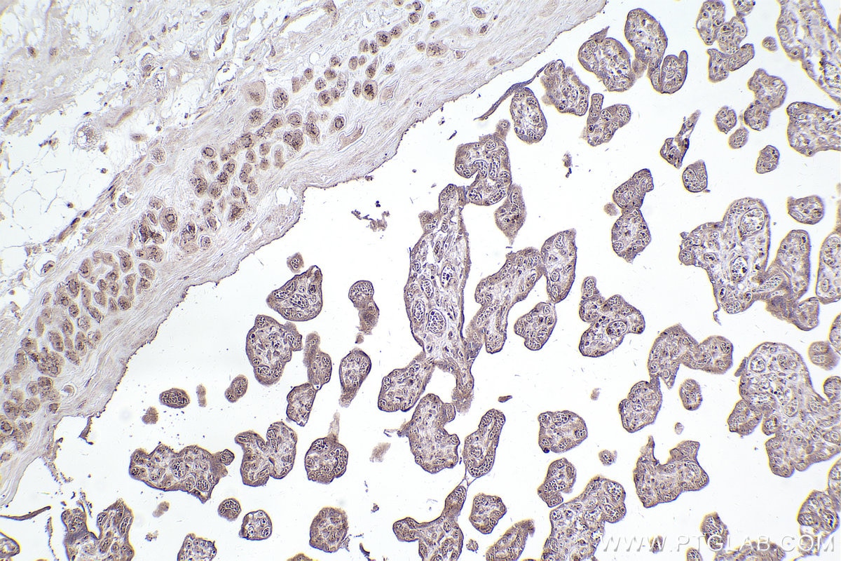 Immunohistochemistry (IHC) staining of human placenta tissue using Giantin Polyclonal antibody (22270-1-AP)