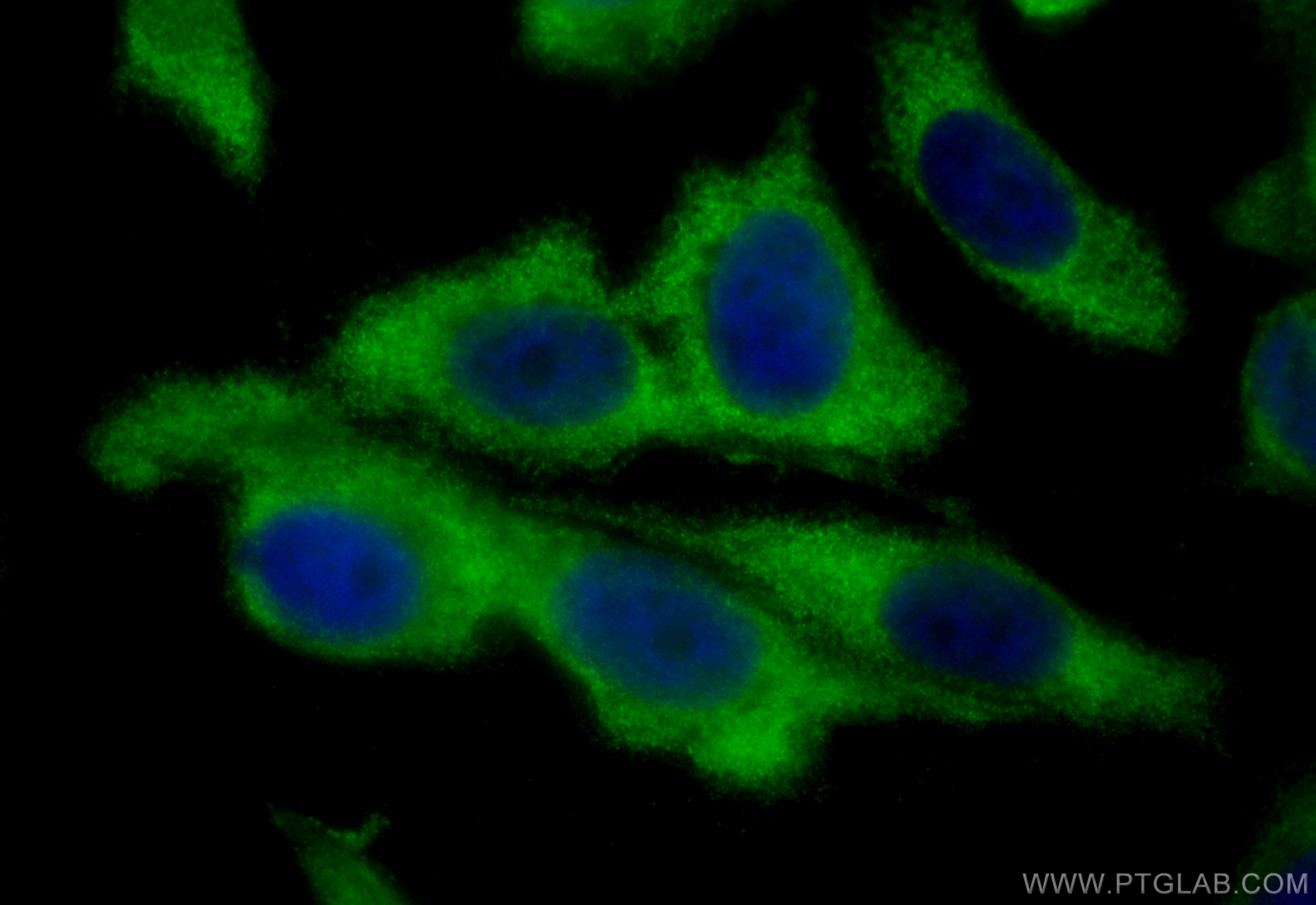 Immunofluorescence (IF) / fluorescent staining of PC-3 cells using CoraLite® Plus 488-conjugated GlnRS Polyclonal ant (CL488-12645)