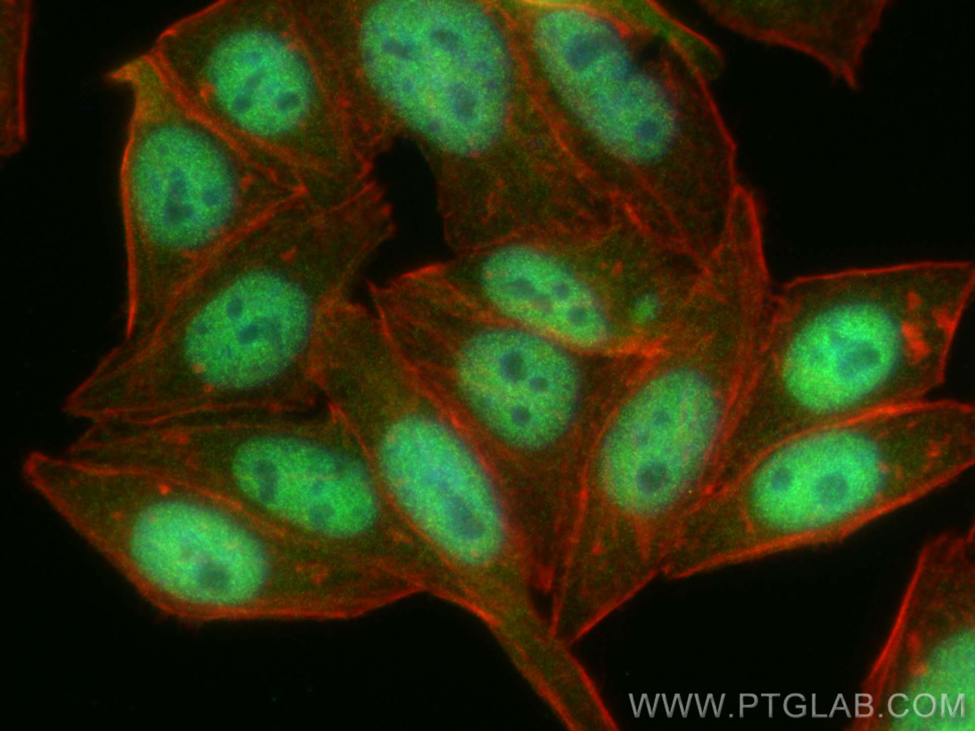 Immunofluorescence (IF) / fluorescent staining of HepG2 cells using Glucocorticoid receptor Recombinant antibody (82619-4-RR)