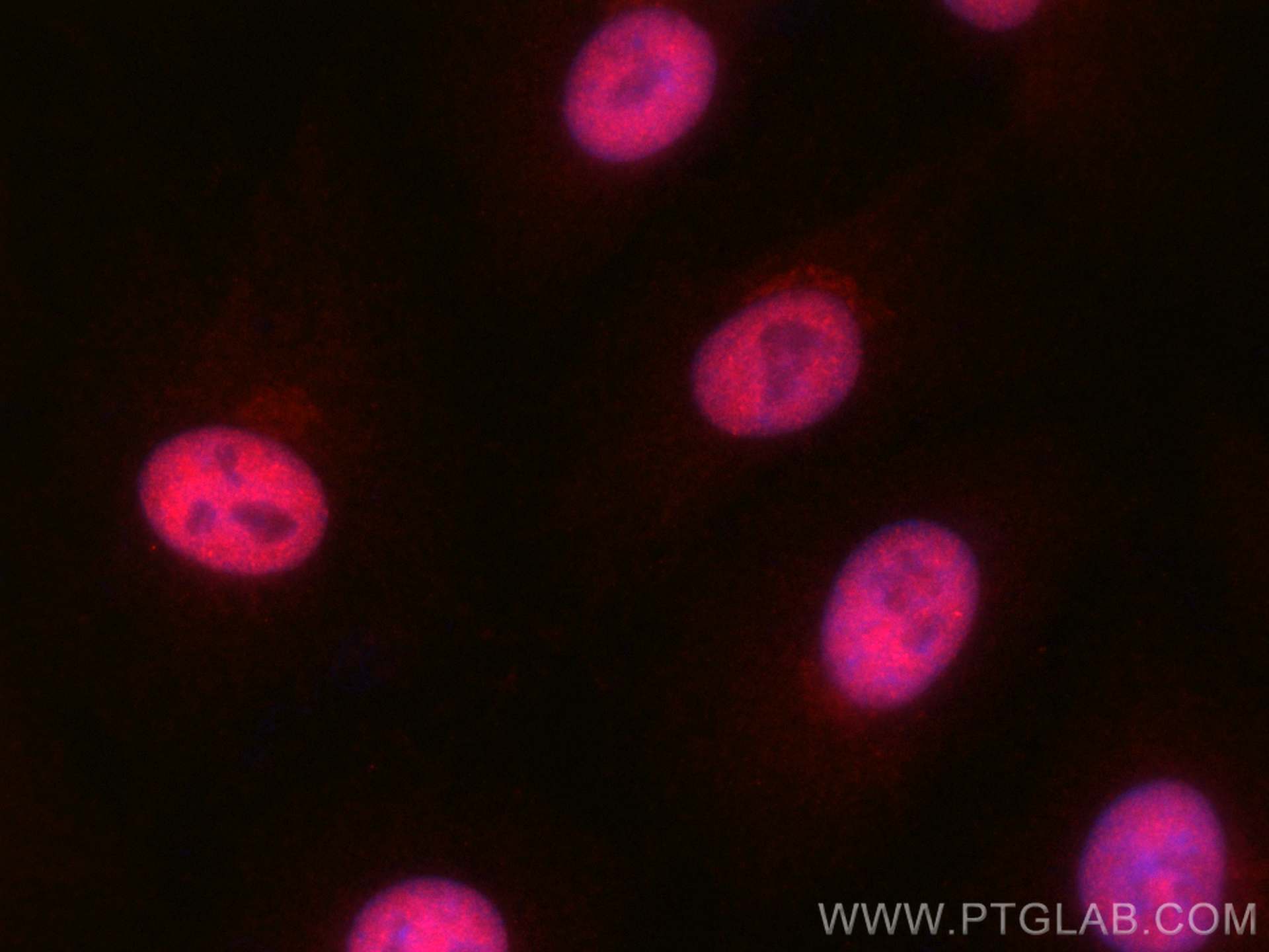 Immunofluorescence (IF) / fluorescent staining of A549 cells using CoraLite®594-conjugated Glucocorticoid receptor Po (CL594-24050)