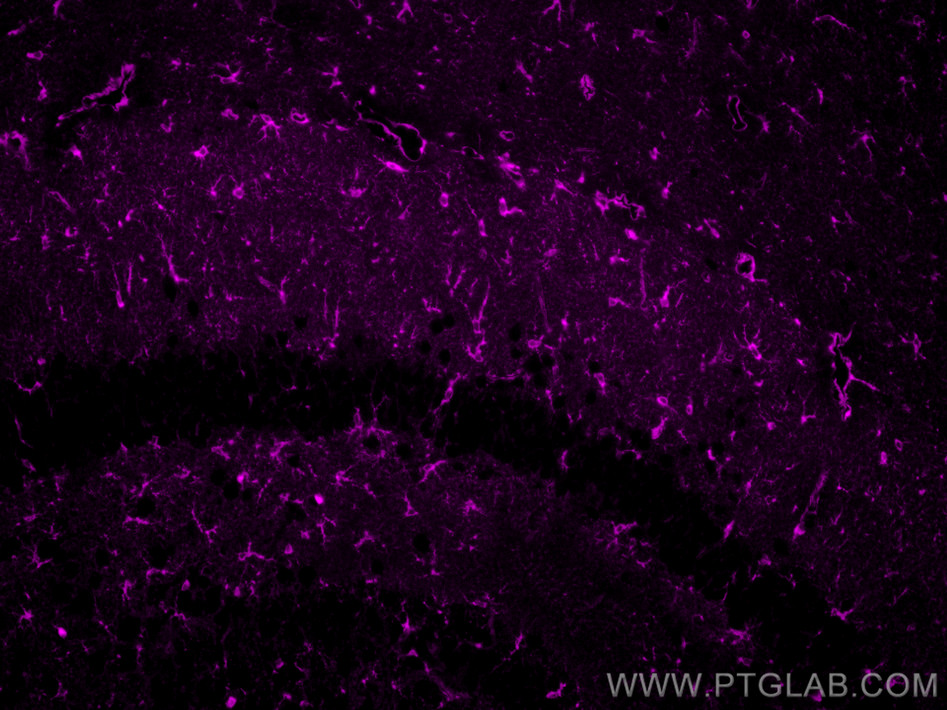 Immunofluorescence (IF) / fluorescent staining of mouse brain tissue using CoraLite® Plus 647-conjugated Glutamine Synthetase (CL647-66323-2)