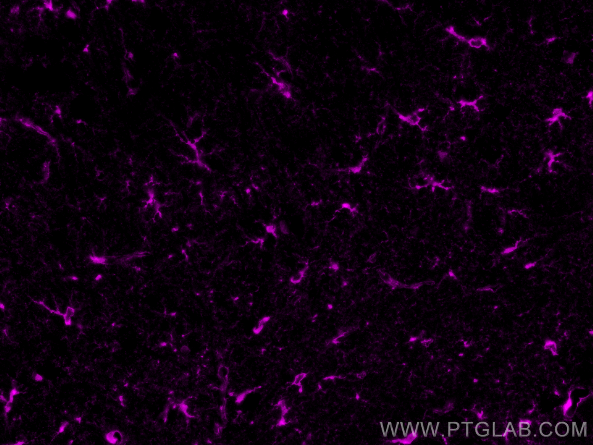 Glutamine Synthetase