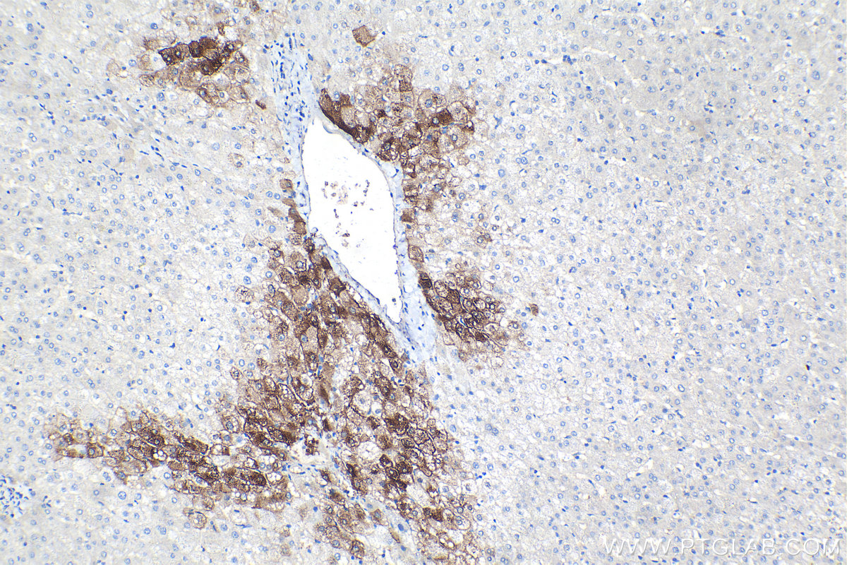 Immunohistochemistry (IHC) staining of human liver tissue using Glutamine Synthetase Monoclonal antibody (66323-2-Ig)