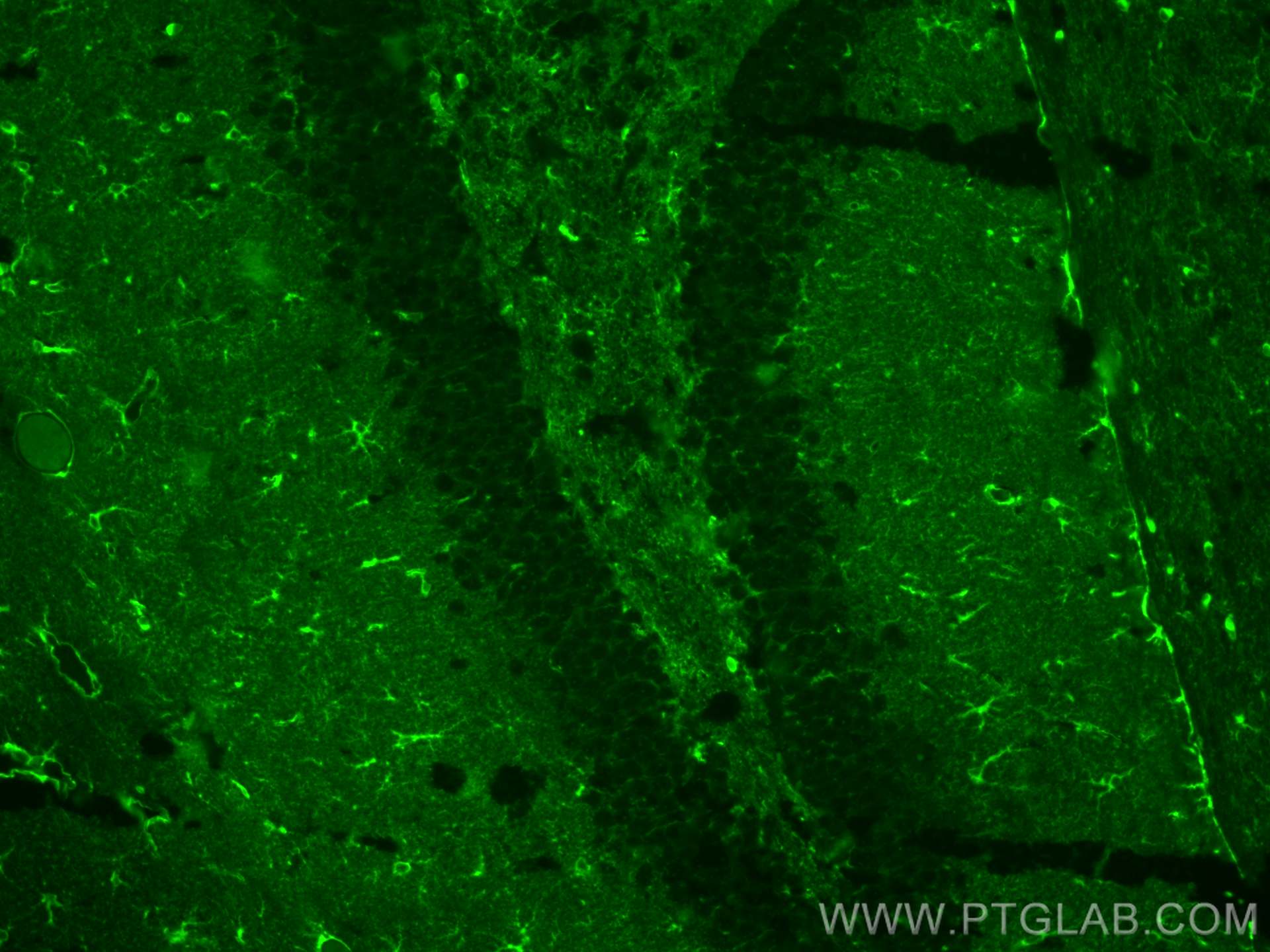 Immunofluorescence (IF) / fluorescent staining of mouse brain tissue using CoraLite® Plus 488-conjugated Glutamine Synthetase (CL488-66323)