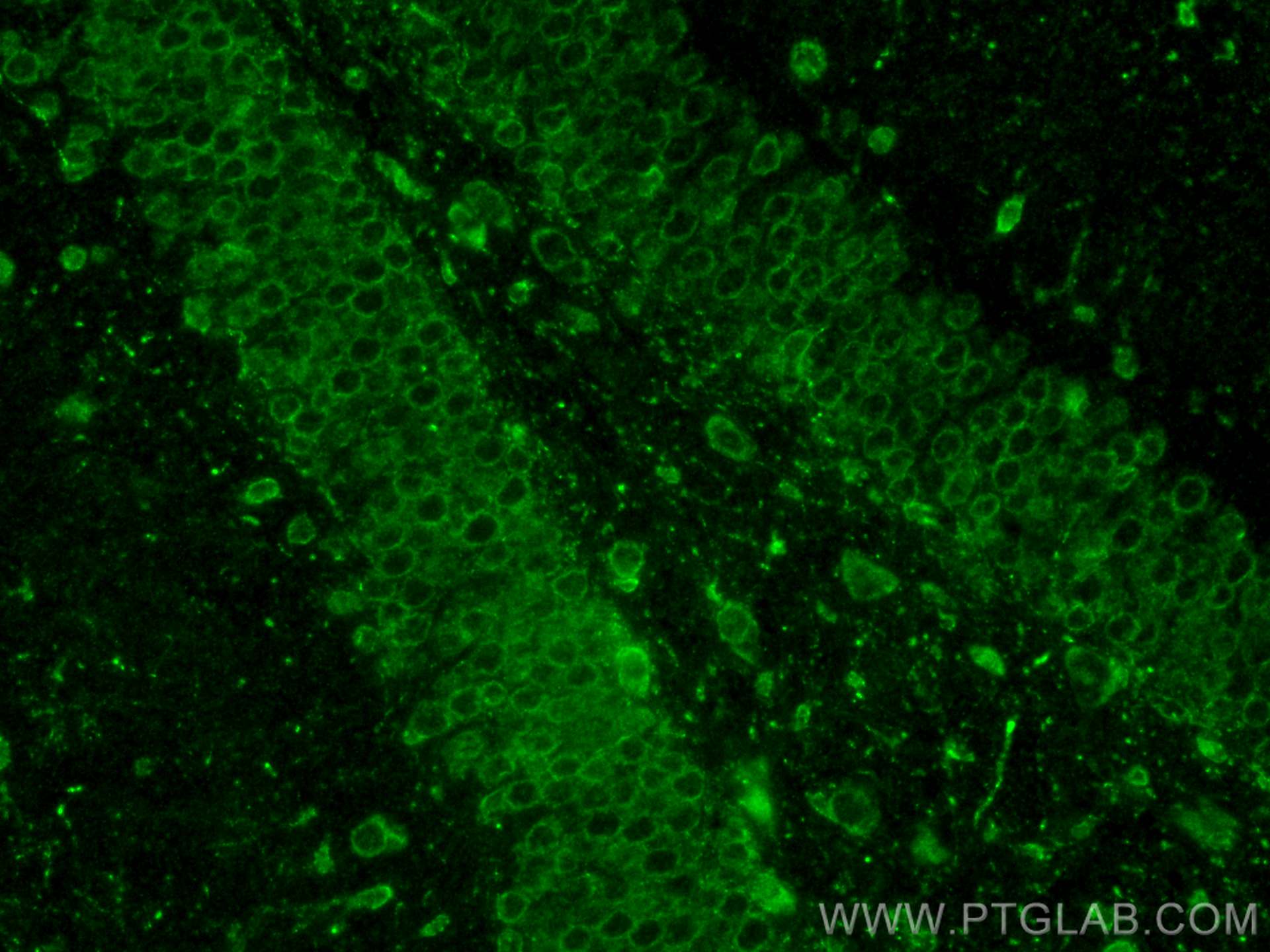 Immunofluorescence (IF) / fluorescent staining of mouse brain tissue using GlyT2 Polyclonal antibody (25948-1-AP)