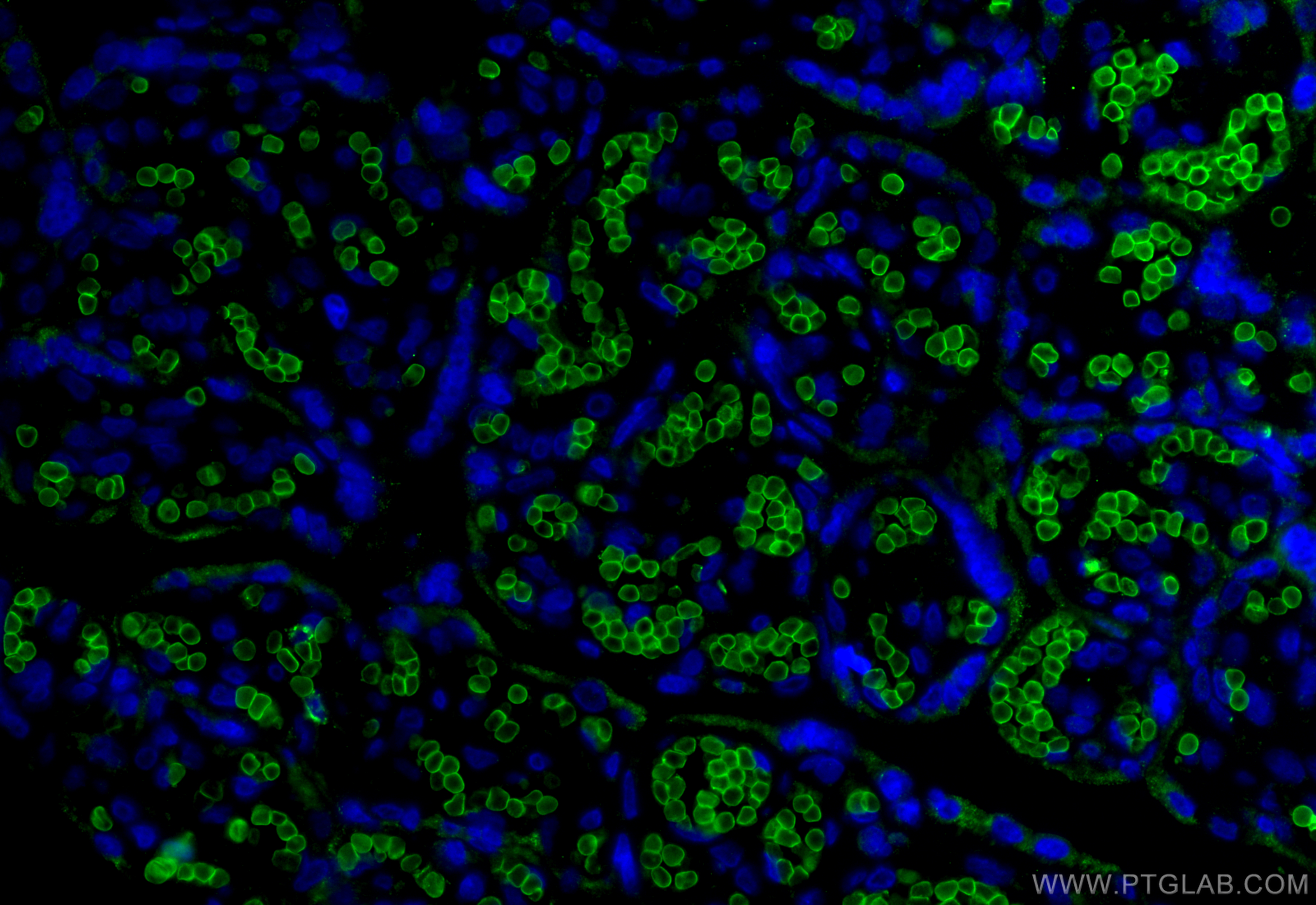 Immunofluorescence (IF) / fluorescent staining of human placenta tissue using Glycophorin A  Monoclonal antibody (66778-1-Ig)