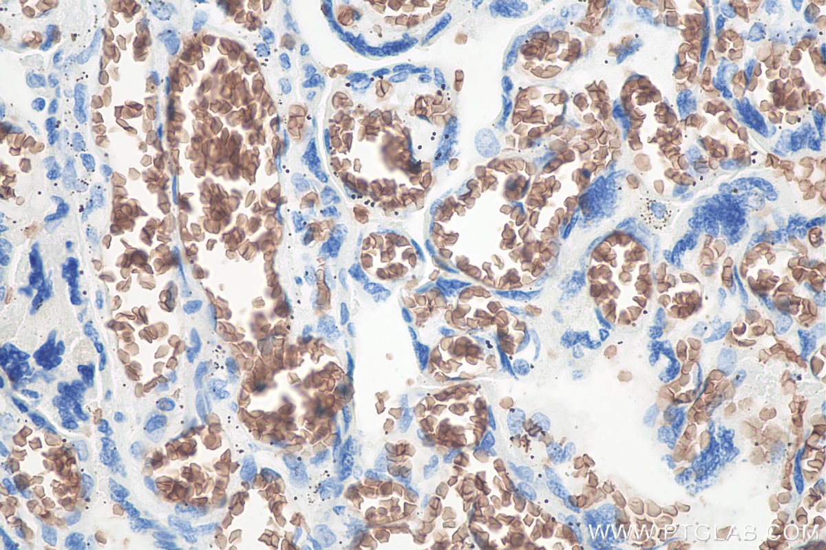 Immunohistochemistry (IHC) staining of human placenta tissue using Glycophorin A/CD235a Monoclonal antibody (66778-1-Ig)